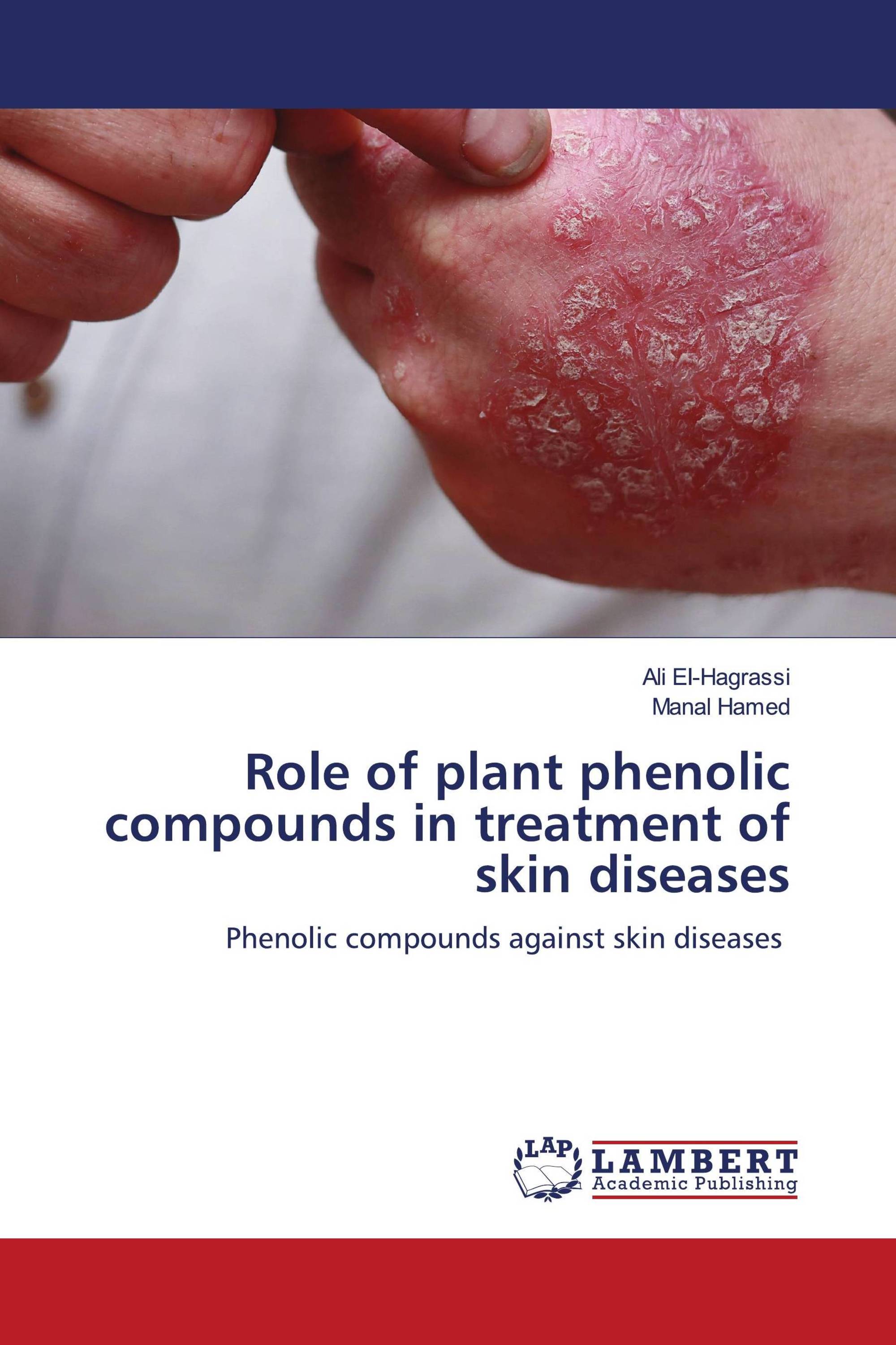 Role of plant phenolic compounds in treatment of skin diseases