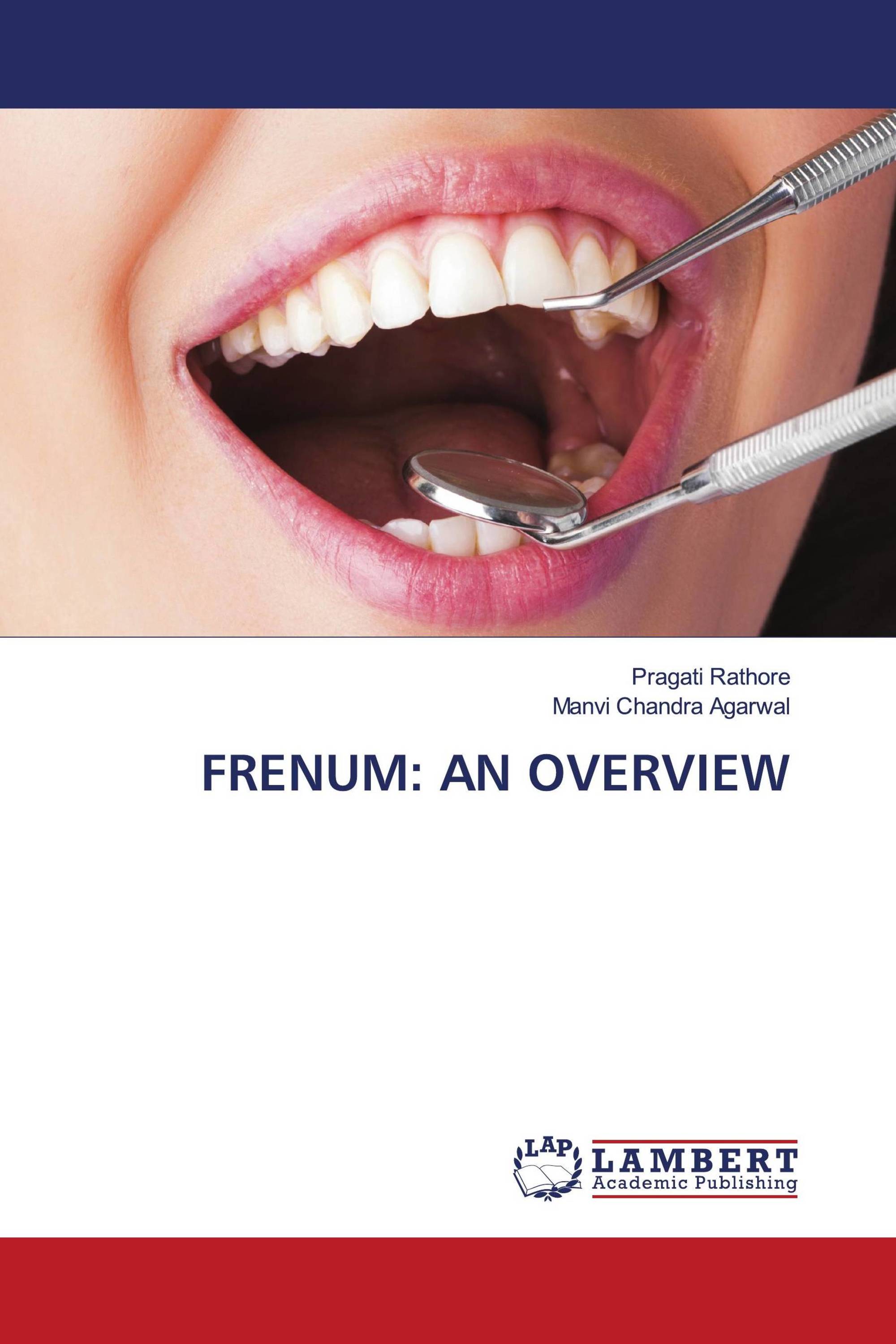 FRENUM: AN OVERVIEW