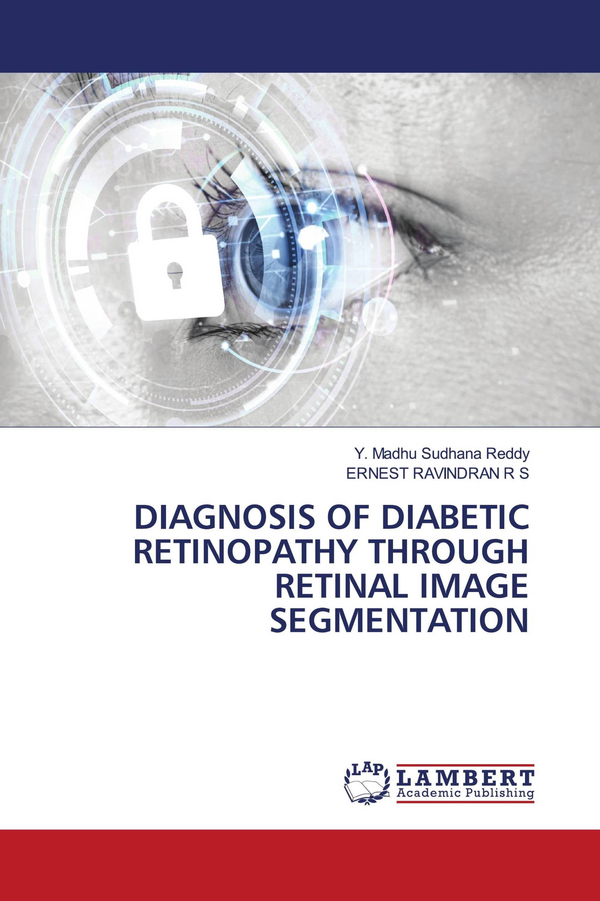 DIAGNOSIS OF DIABETIC RETINOPATHY THROUGH RETINAL IMAGE SEGMENTATION