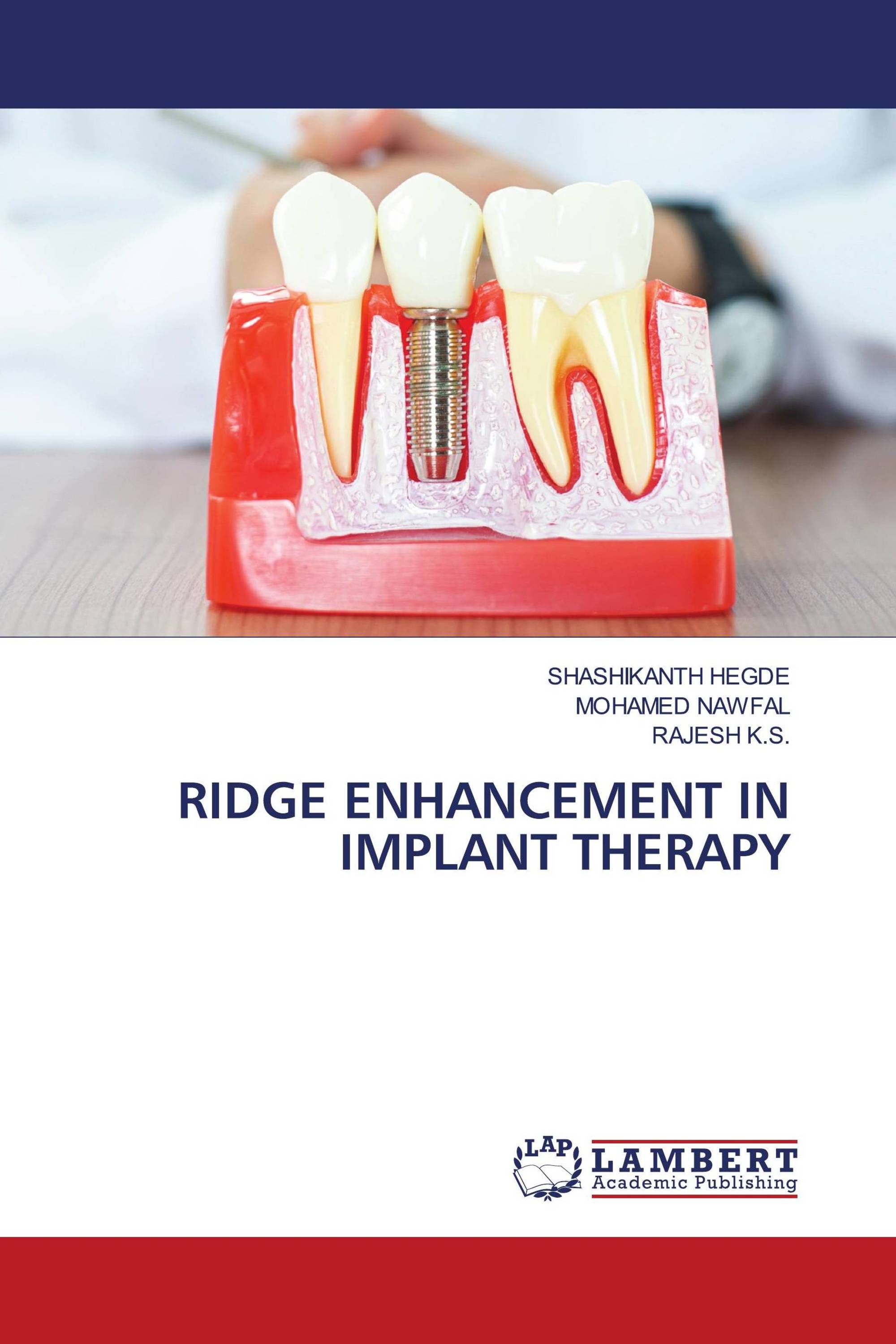 RIDGE ENHANCEMENT IN IMPLANT THERAPY