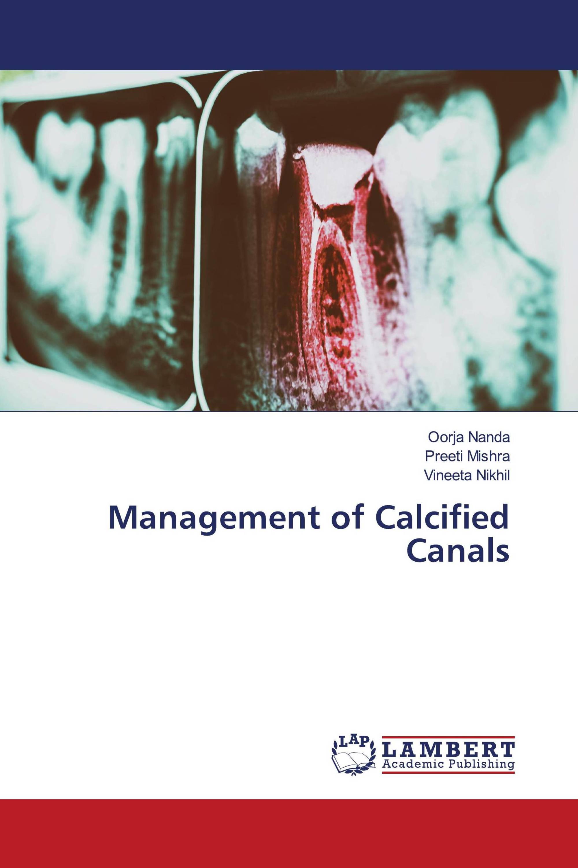 Management of Calcified Canals