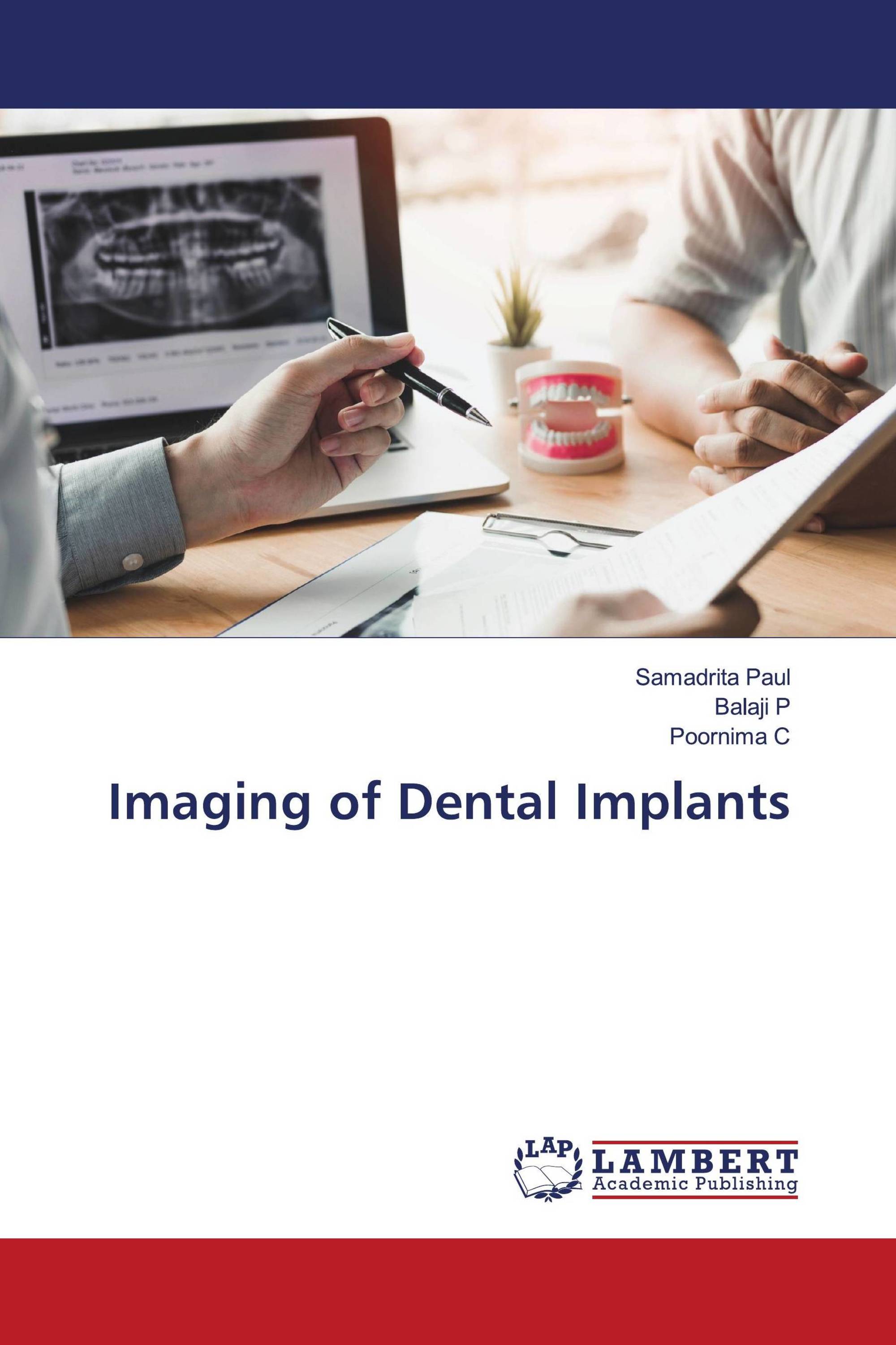 Imaging of Dental Implants