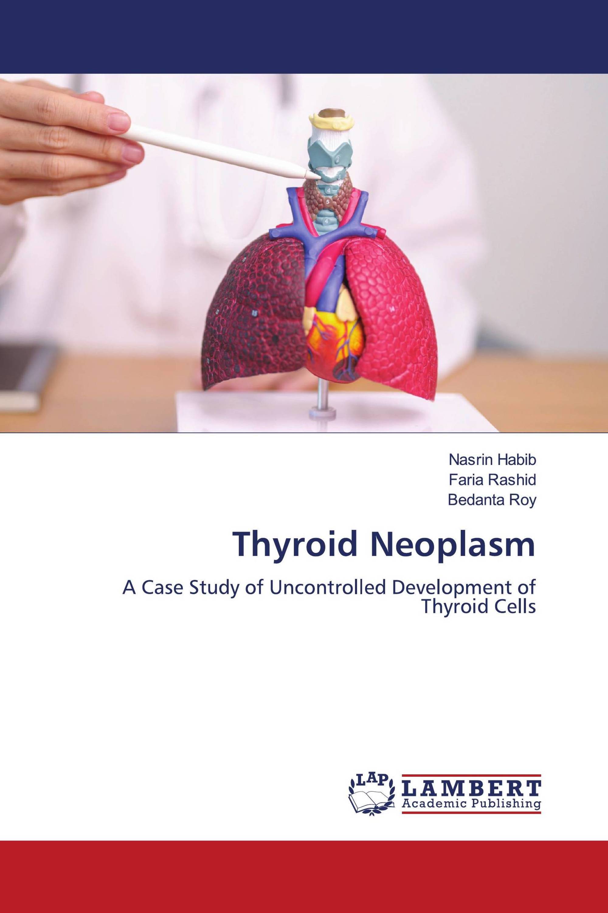 Thyroid Neoplasm