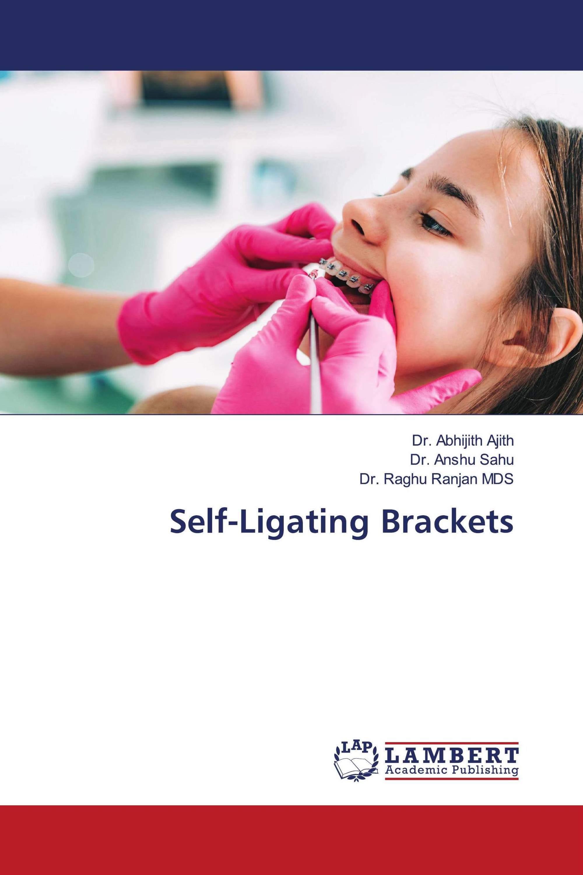 Self-Ligating Brackets