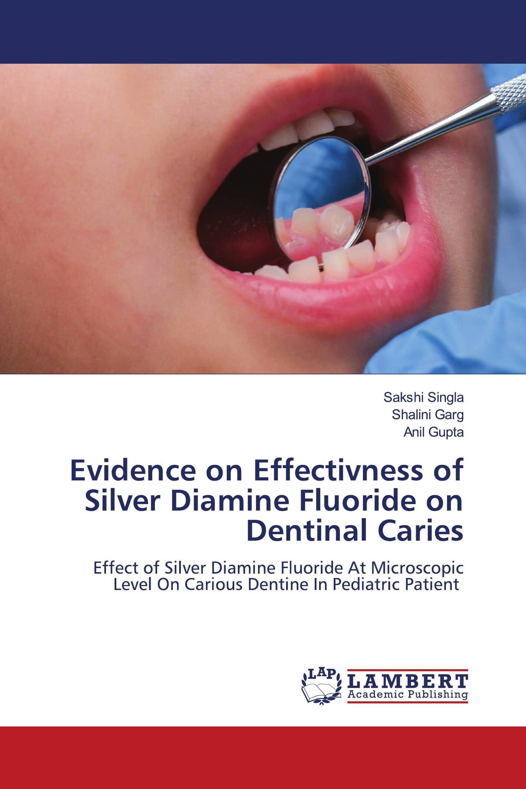 Evidence on Effectivness of Silver Diamine Fluoride on Dentinal Caries