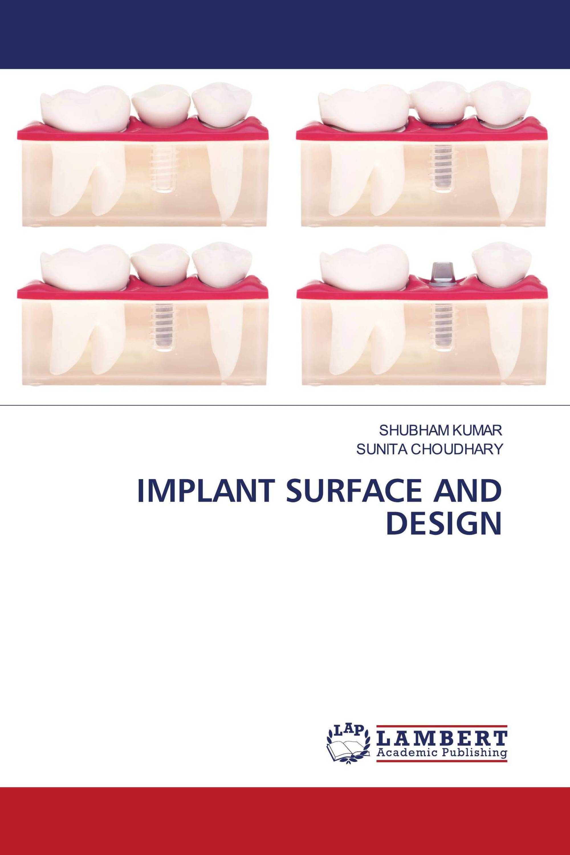 IMPLANT SURFACE AND DESIGN