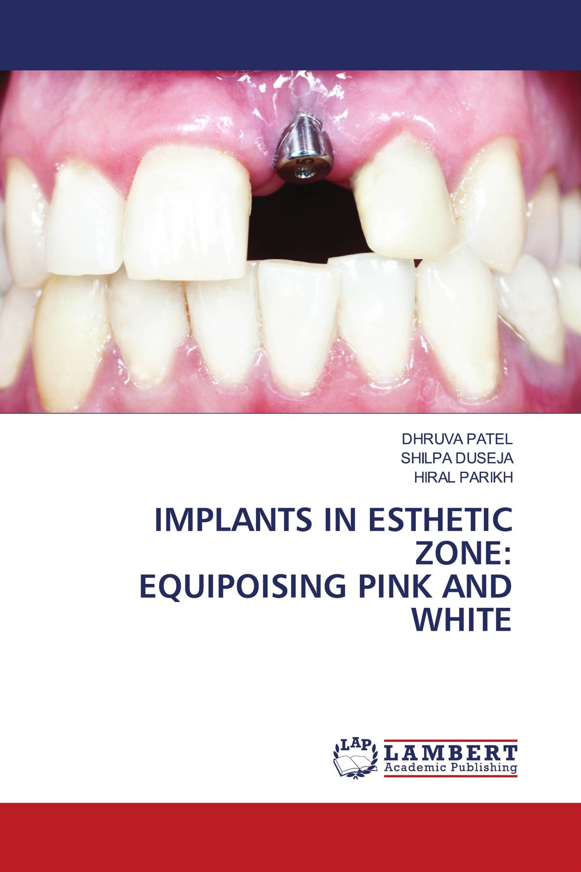 IMPLANTS IN ESTHETIC ZONE: EQUIPOISING PINK AND WHITE