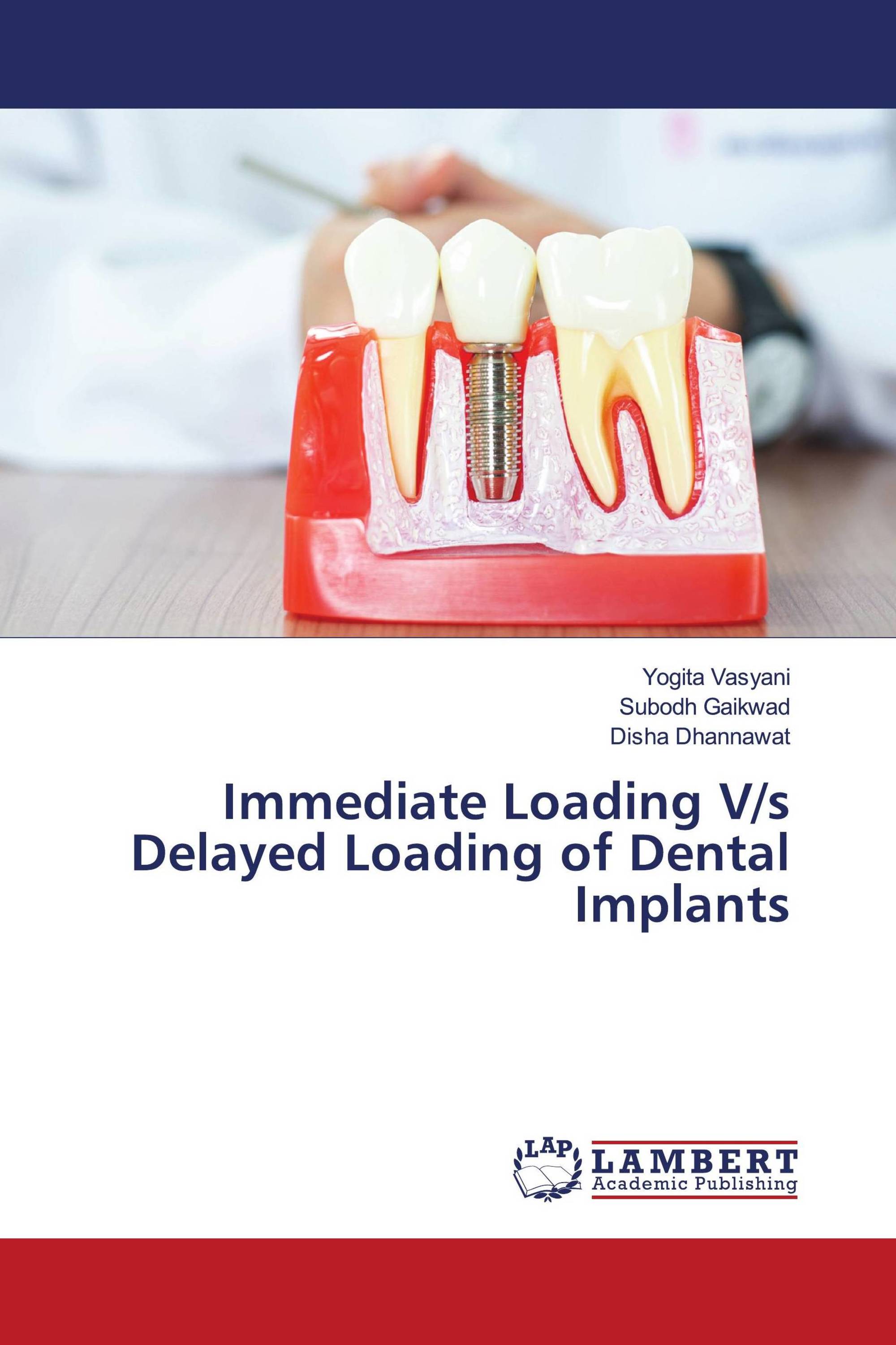 Immediate Loading V/s Delayed Loading of Dental Implants