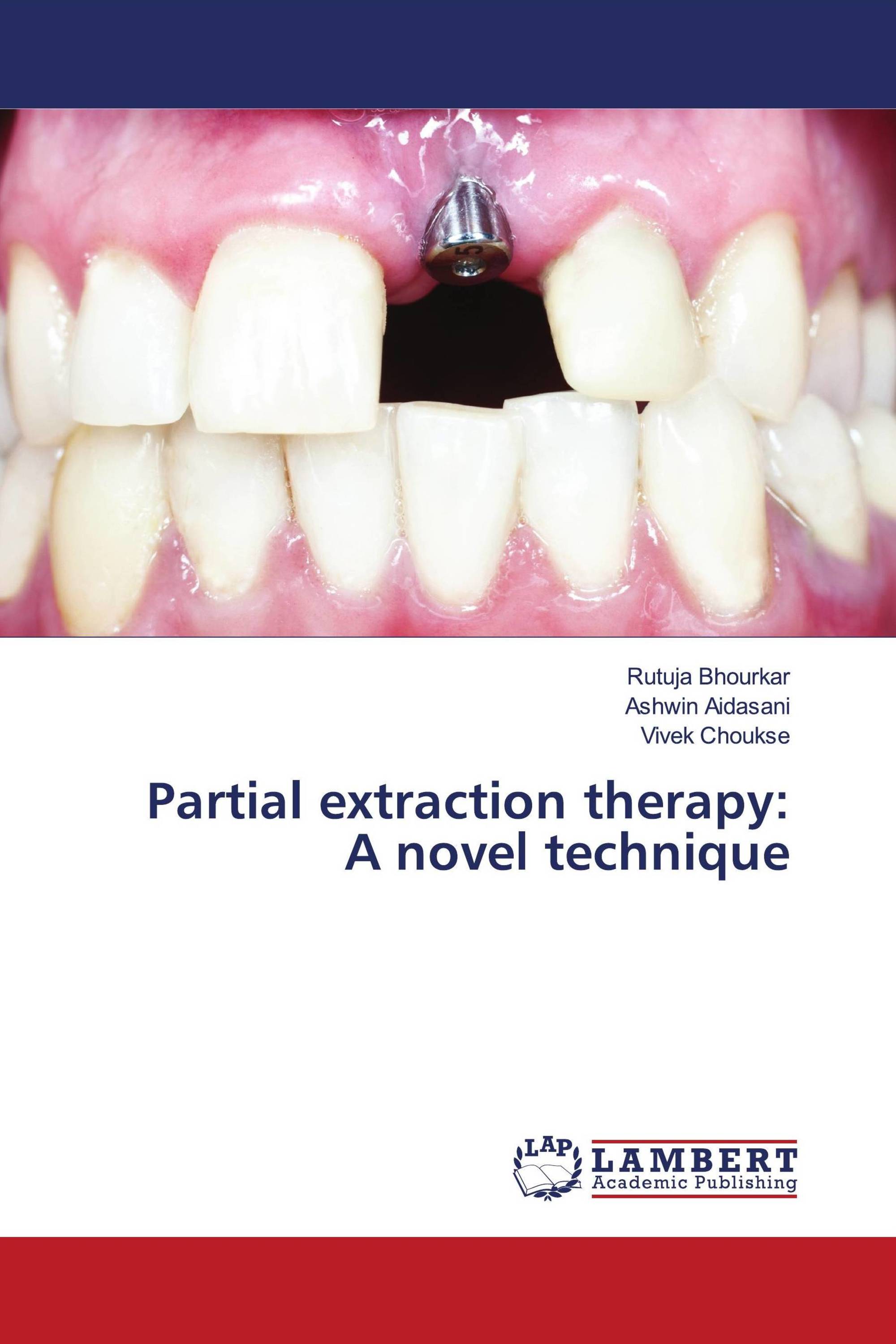 Partial extraction therapy: A novel technique