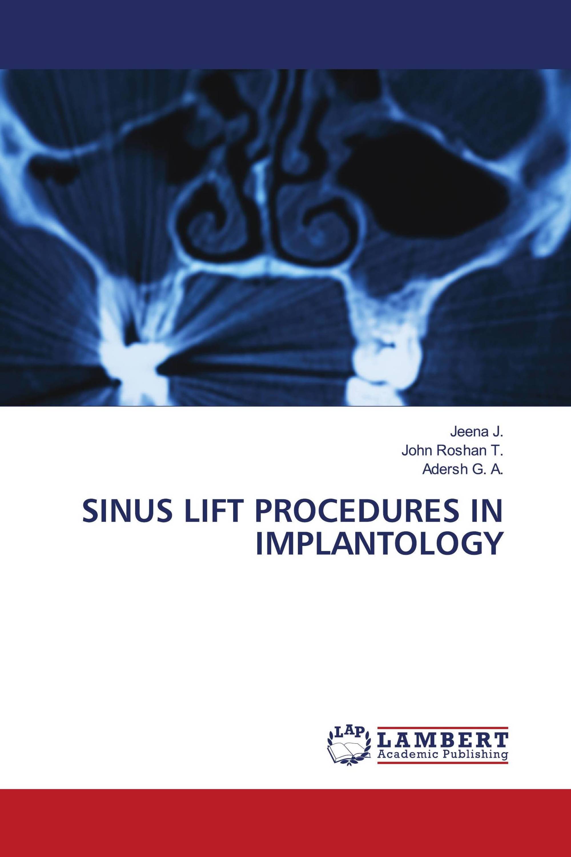 SINUS LIFT PROCEDURES IN IMPLANTOLOGY