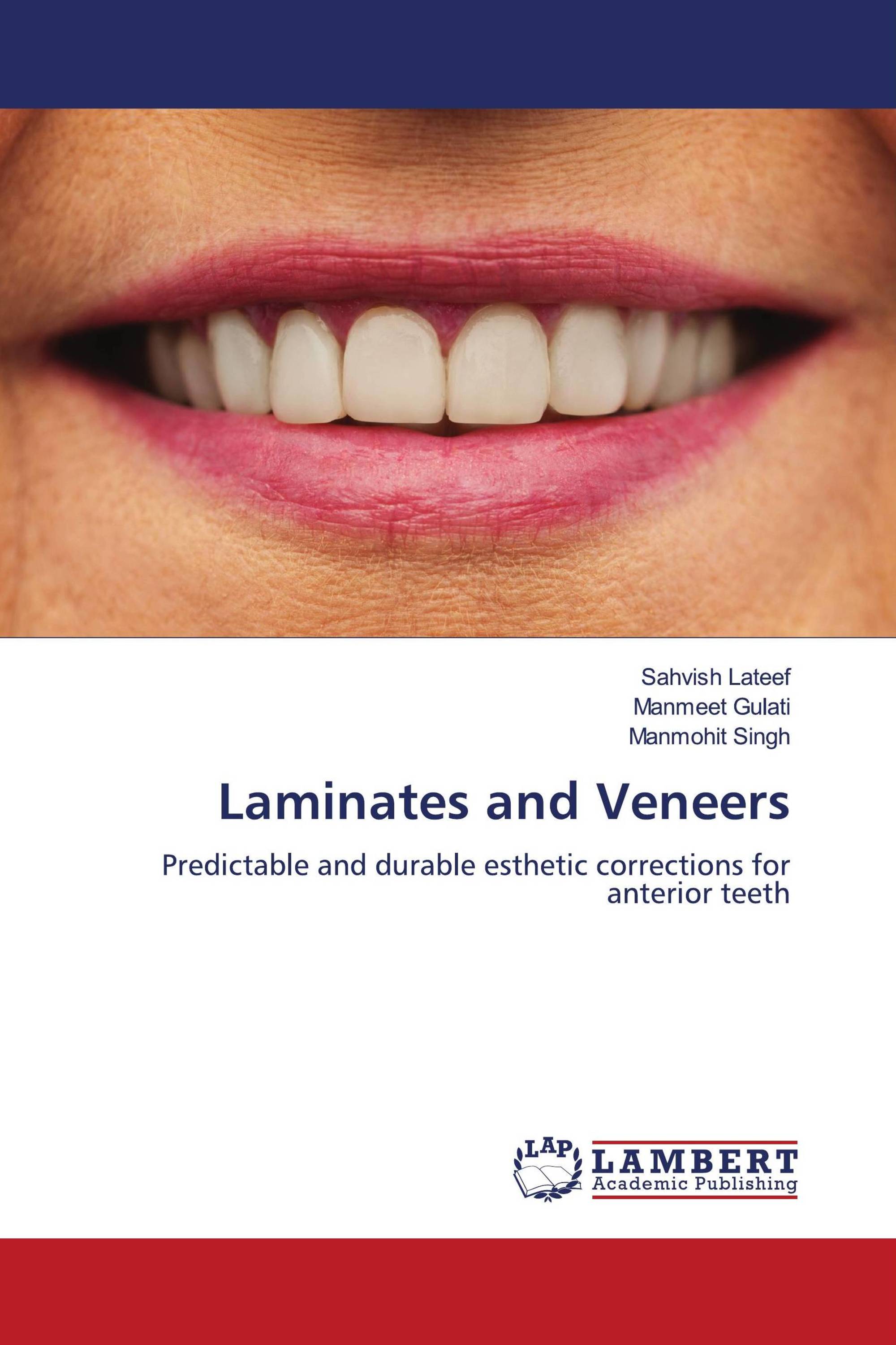 Laminates and Veneers