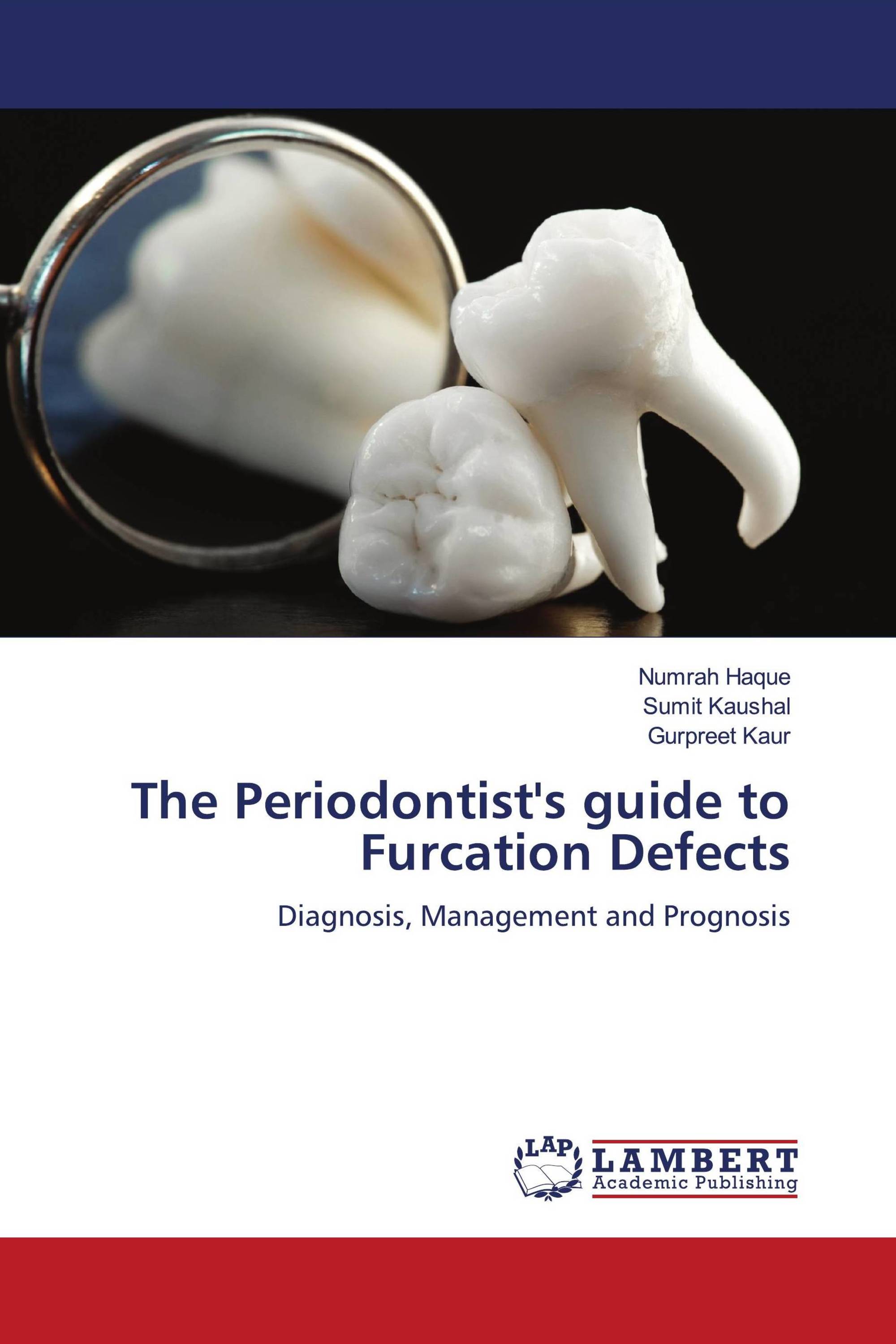 The Periodontist's guide to Furcation Defects