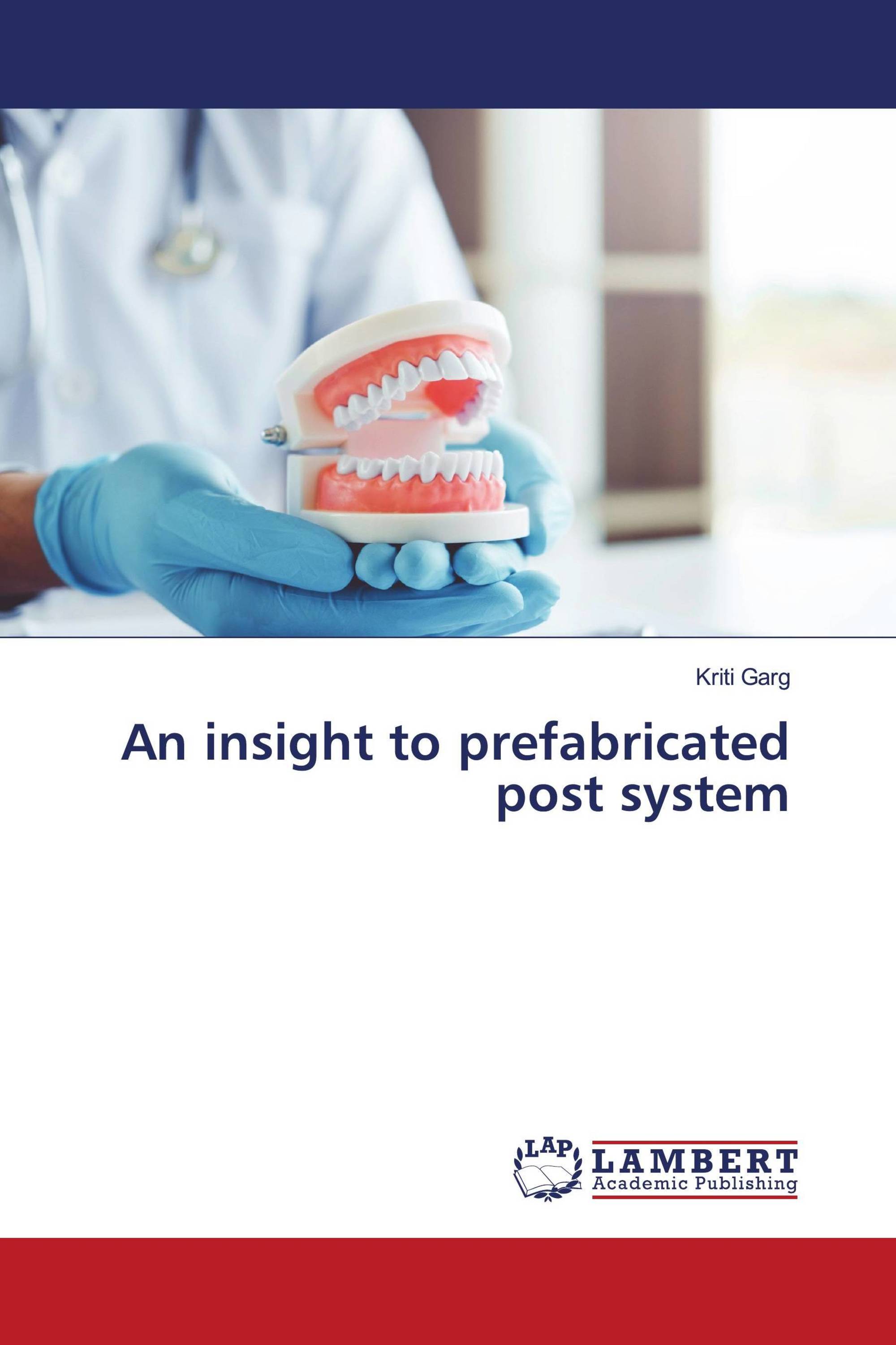 An insight to prefabricated post system