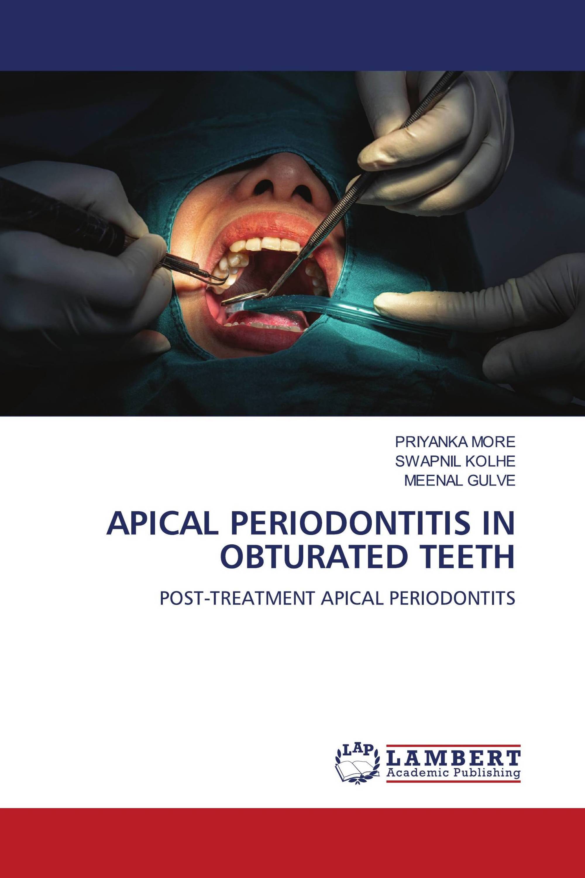 APICAL PERIODONTITIS IN OBTURATED TEETH