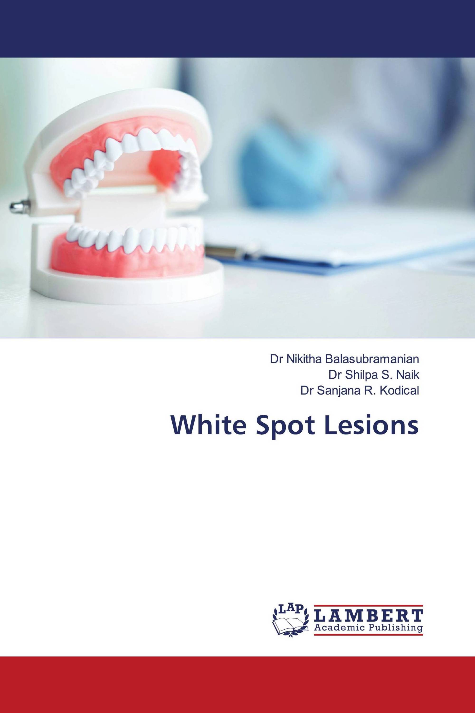 White Spot Lesions