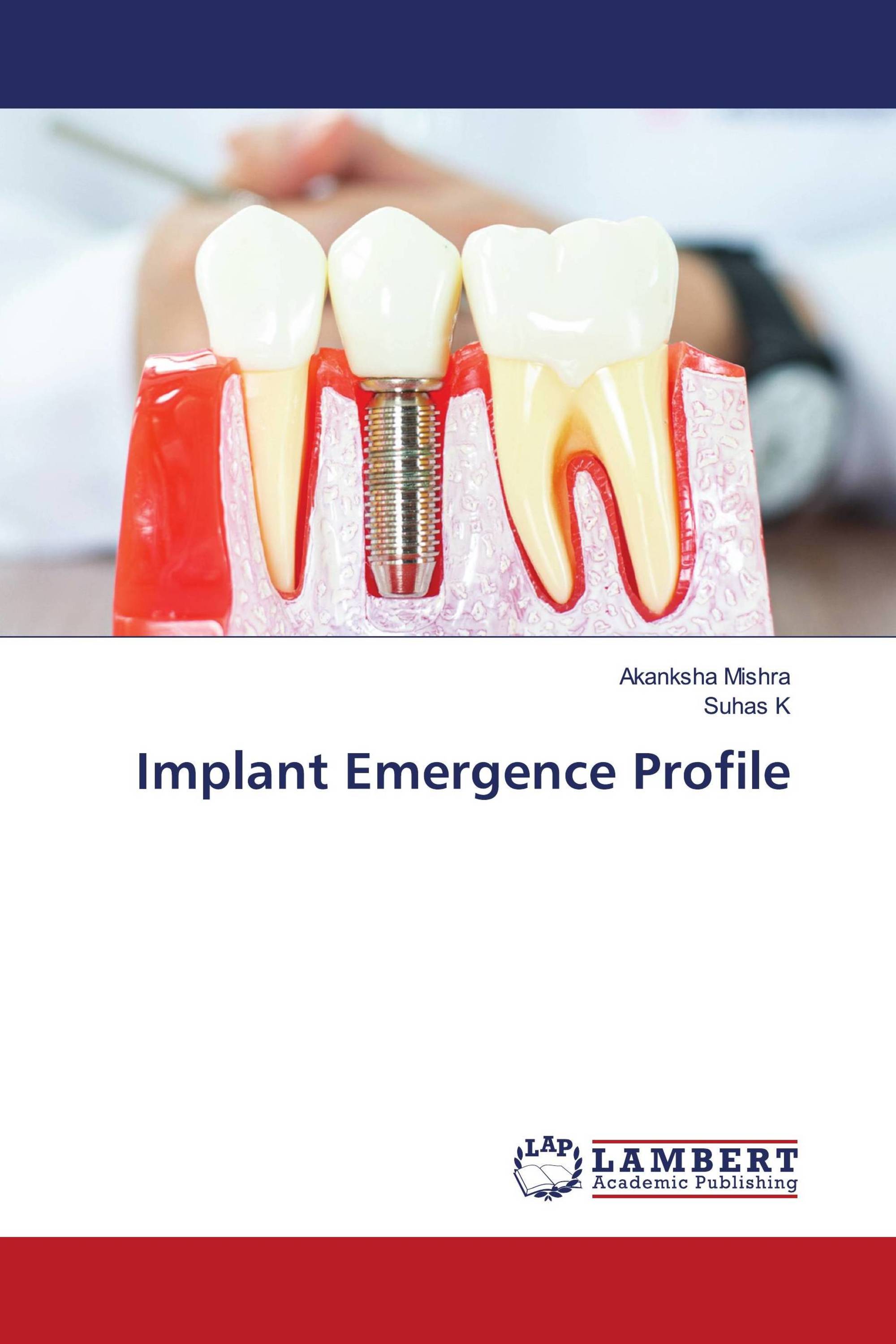 Implant Emergence Profile