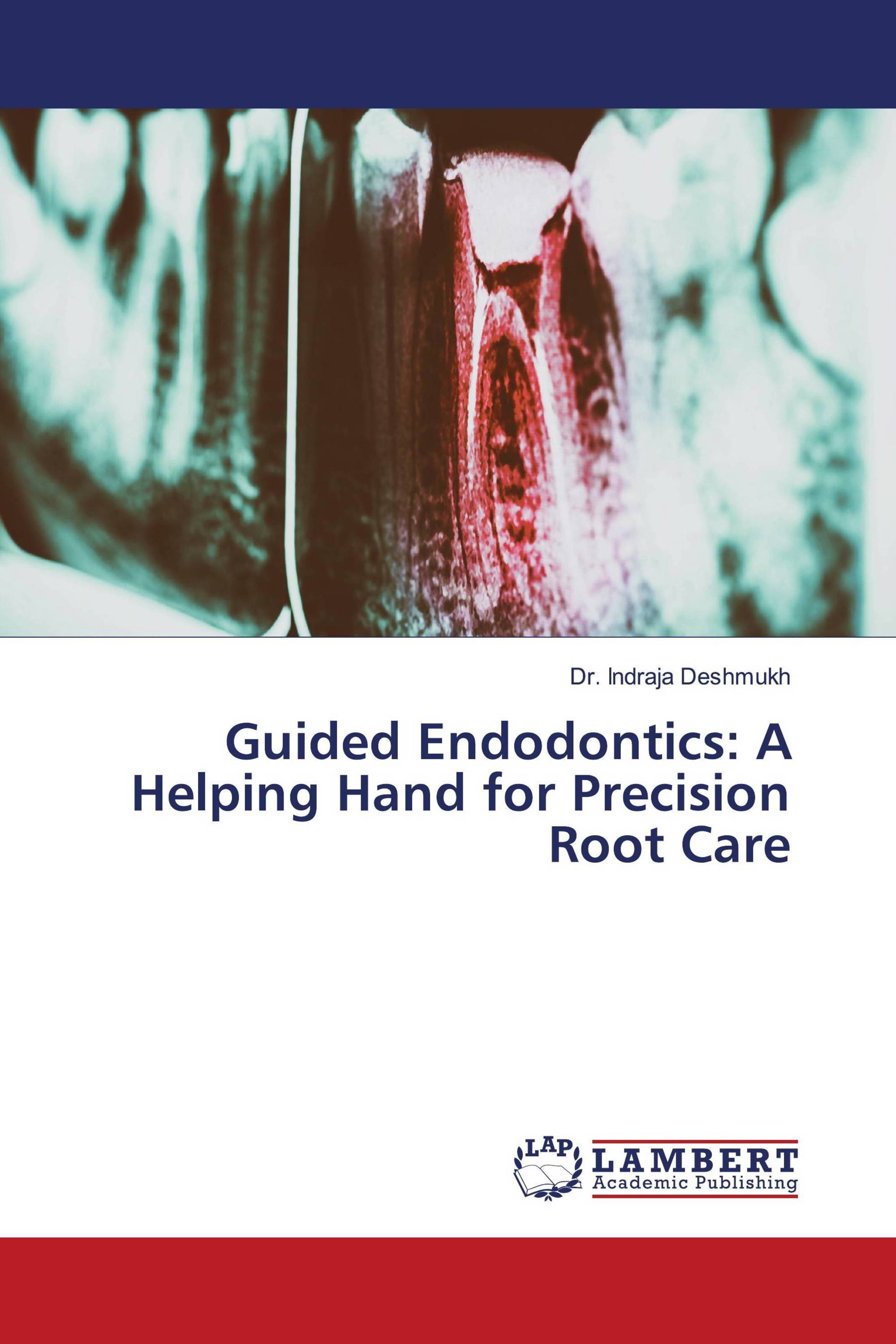 Guided Endodontics: A Helping Hand for Precision Root Care