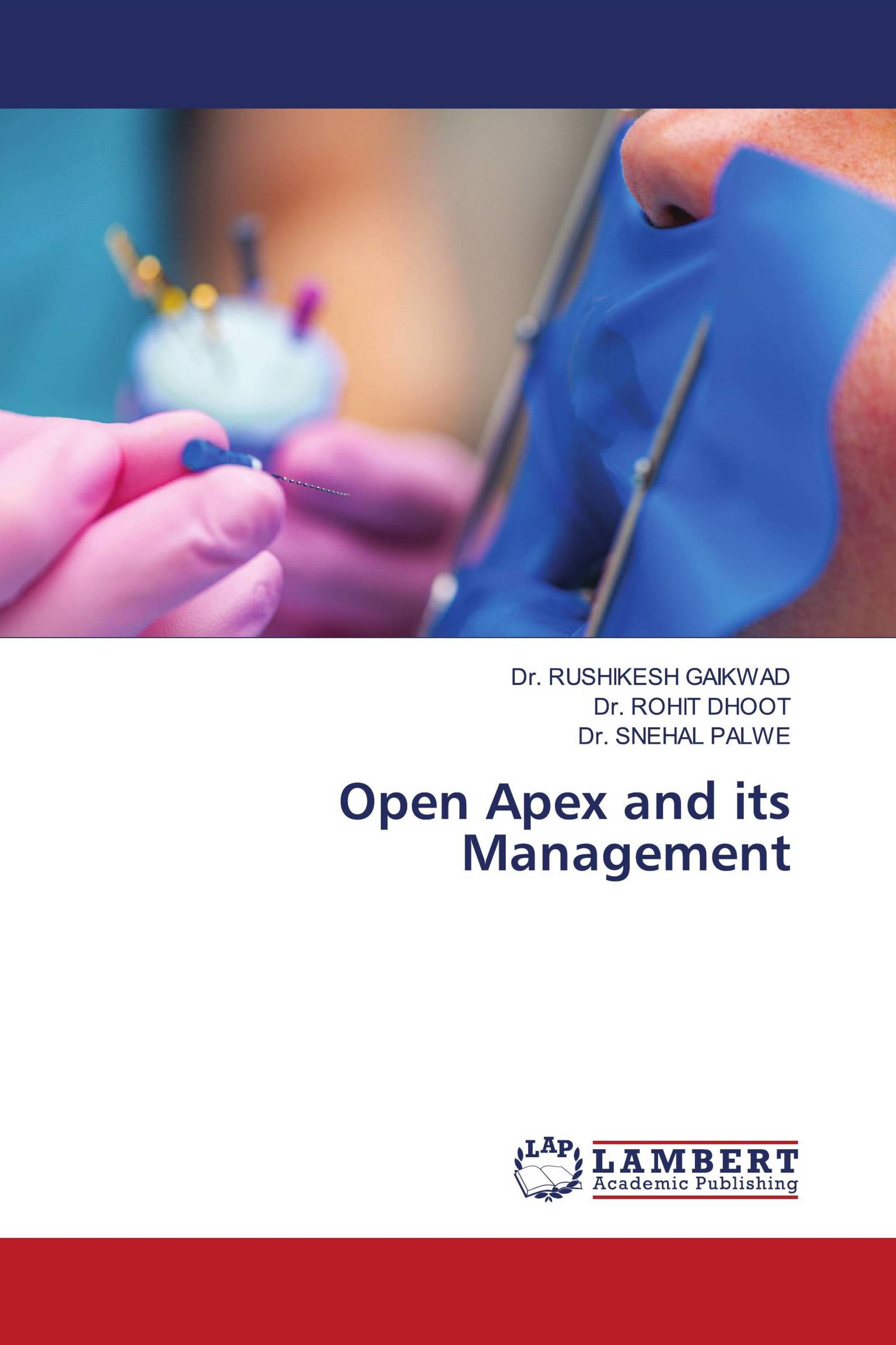 Open Apex and its Management