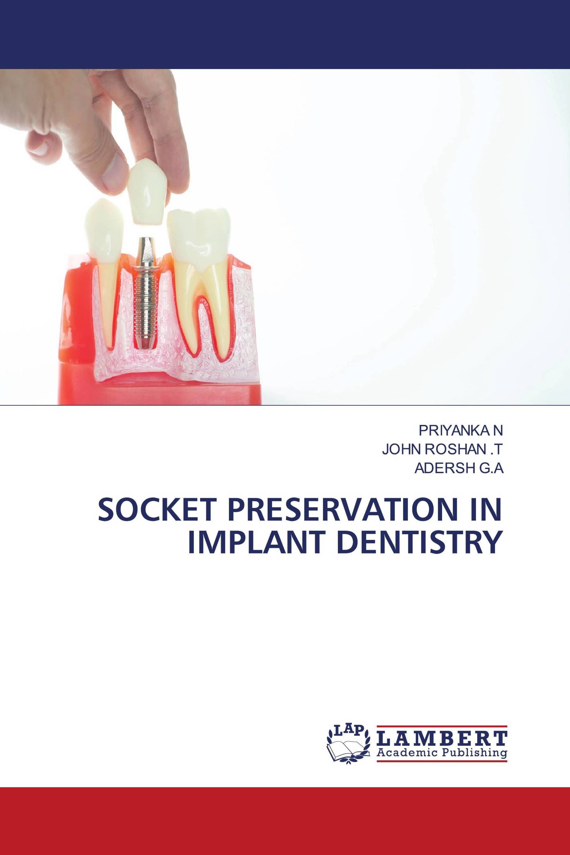 SOCKET PRESERVATION IN IMPLANT DENTISTRY