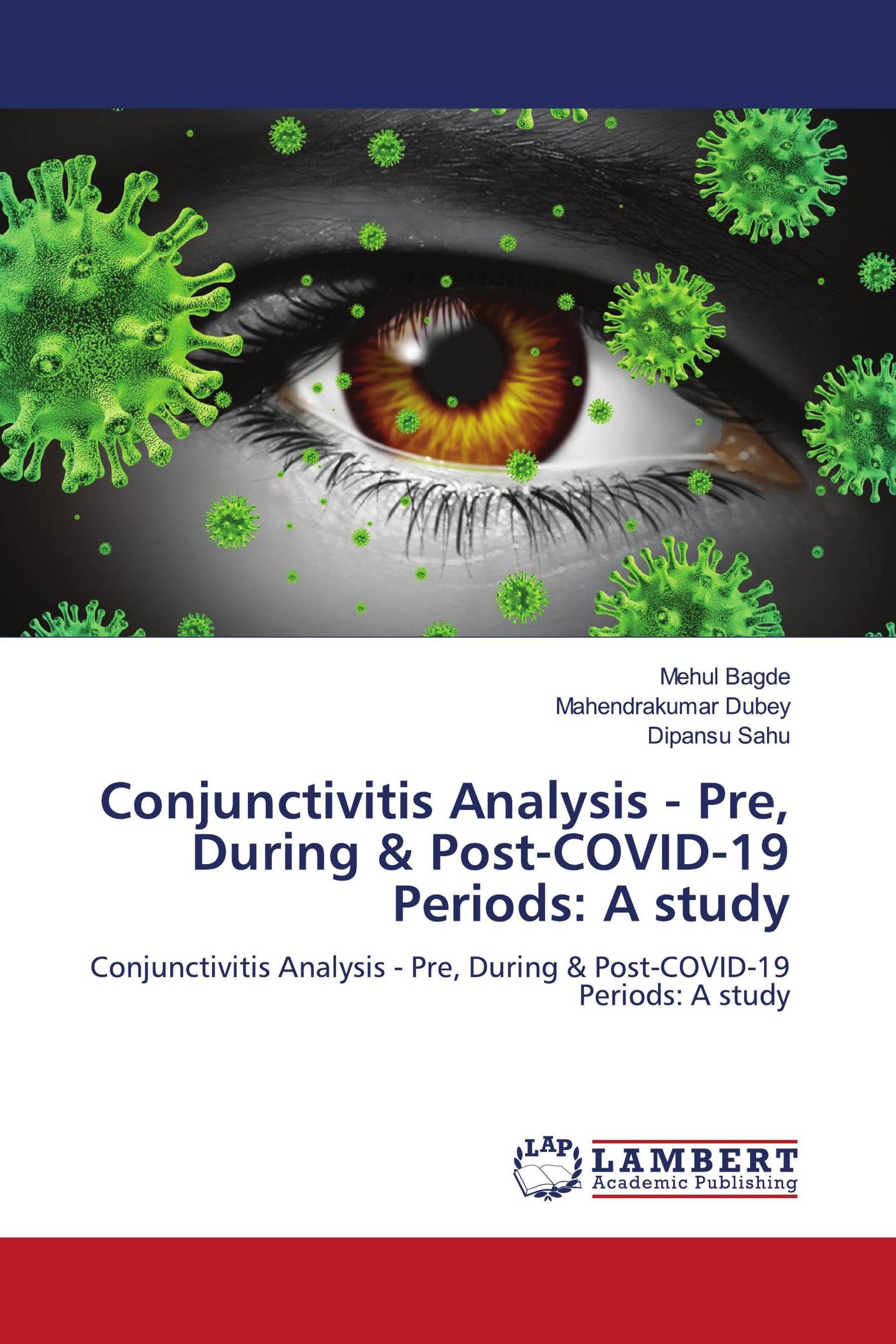 Conjunctivitis Analysis - Pre, During & Post-COVID-19 Periods: A study