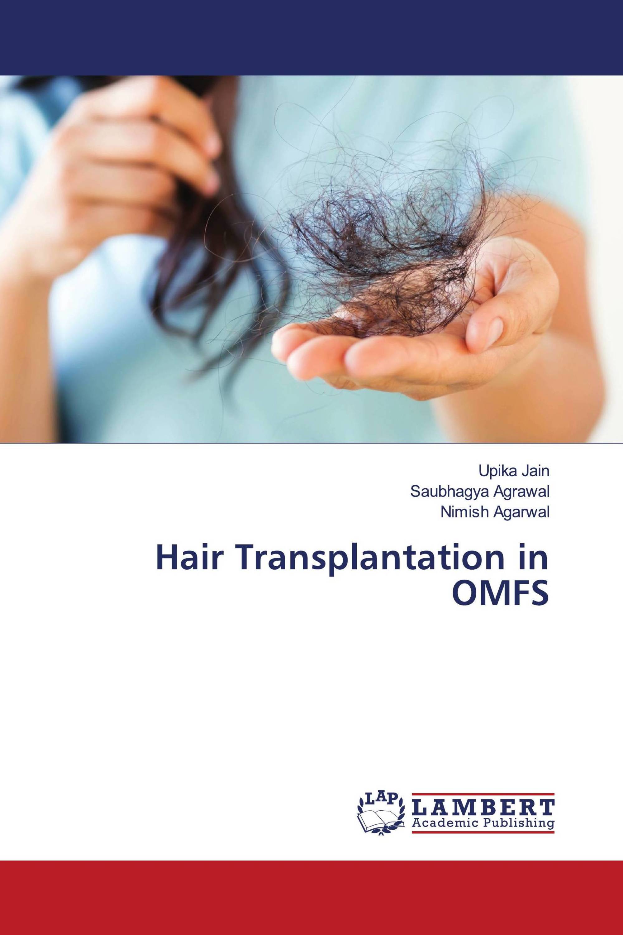 Hair Transplantation in OMFS