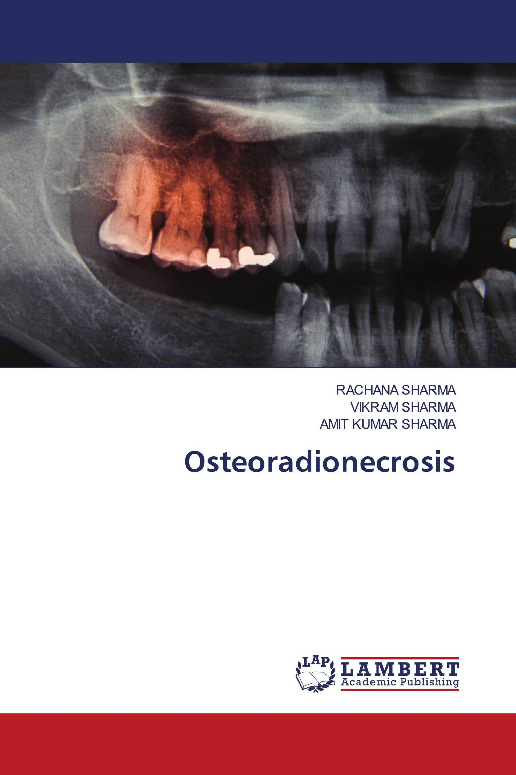 Osteoradionecrosis