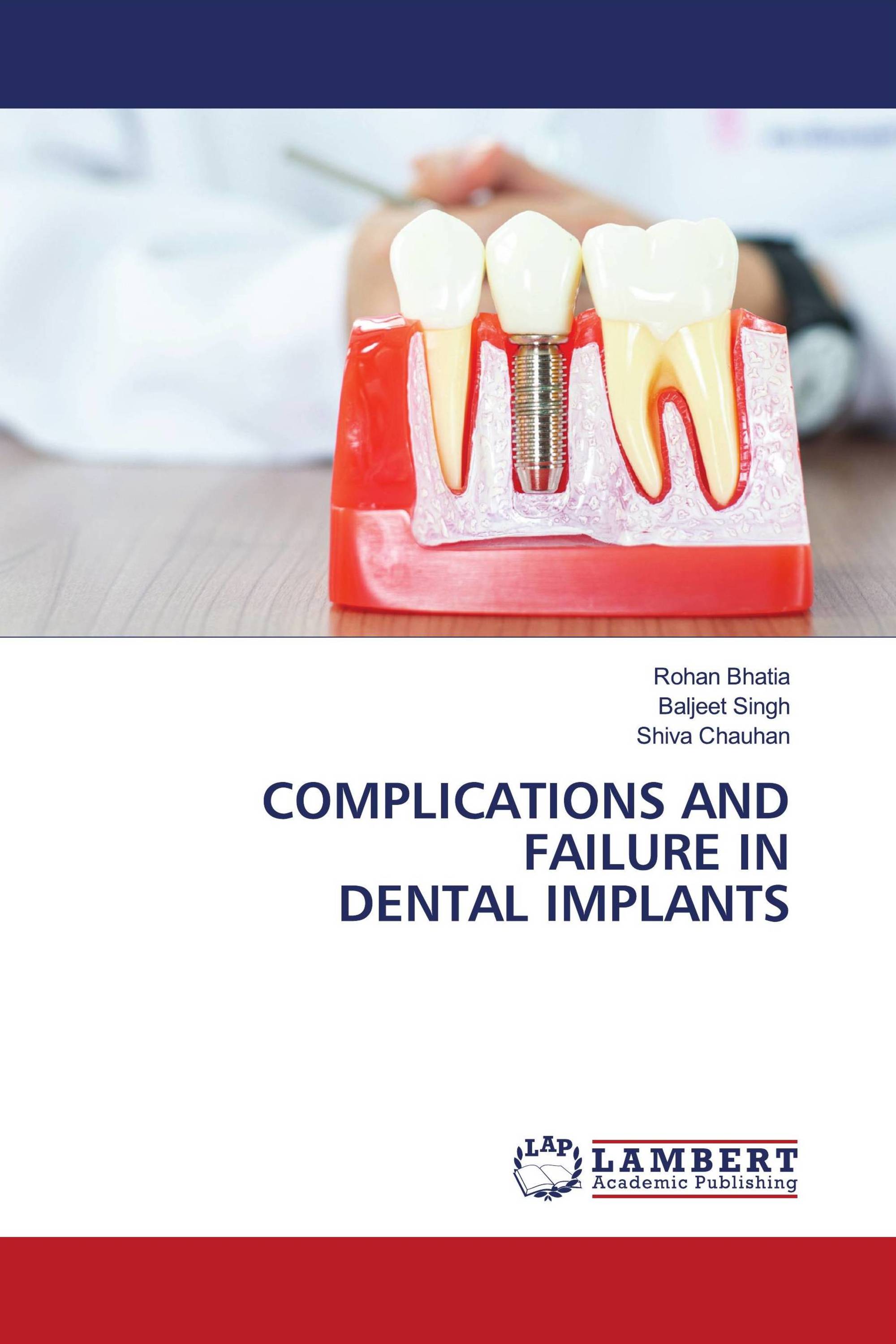 COMPLICATIONS AND FAILURE IN DENTAL IMPLANTS