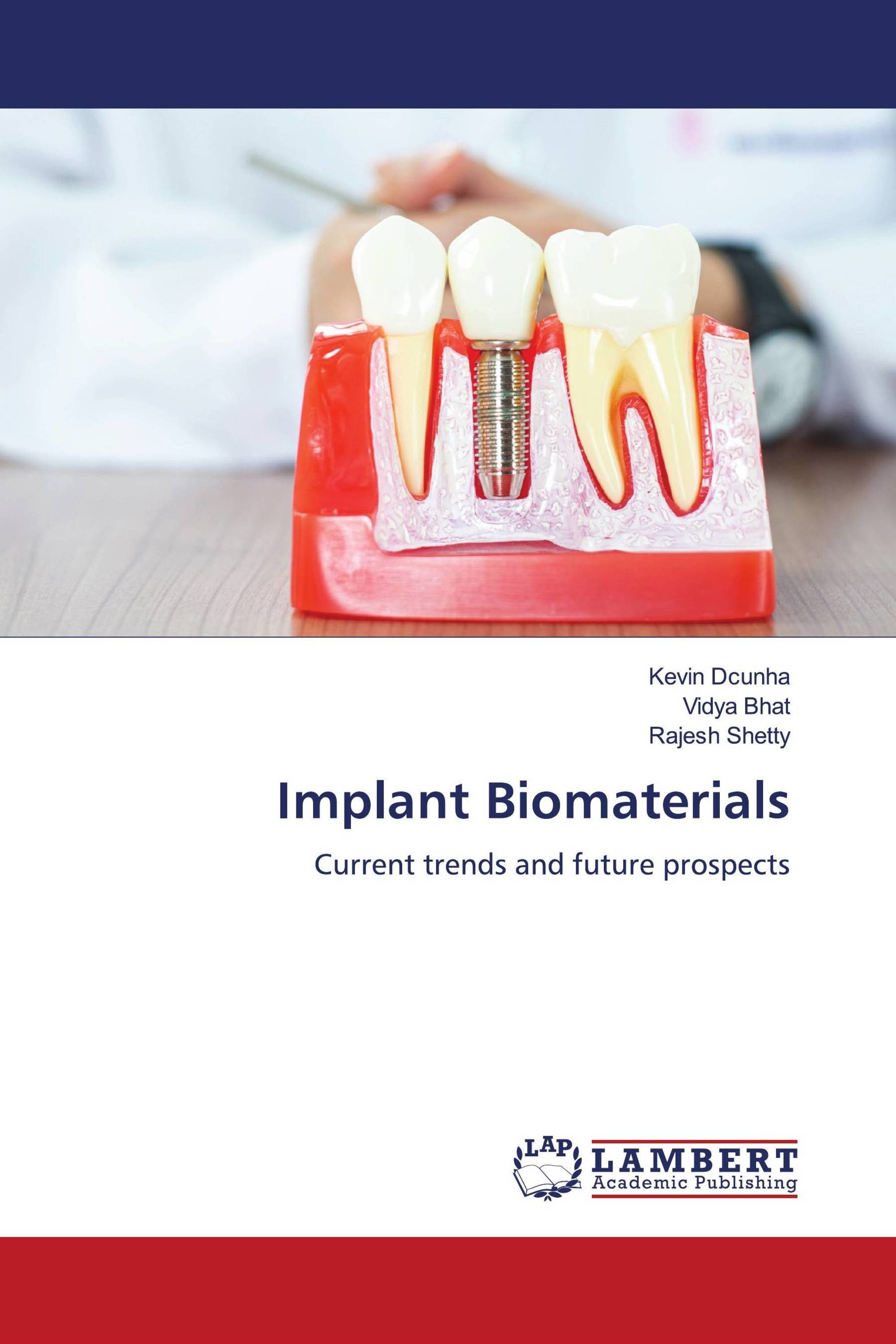 Implant Biomaterials