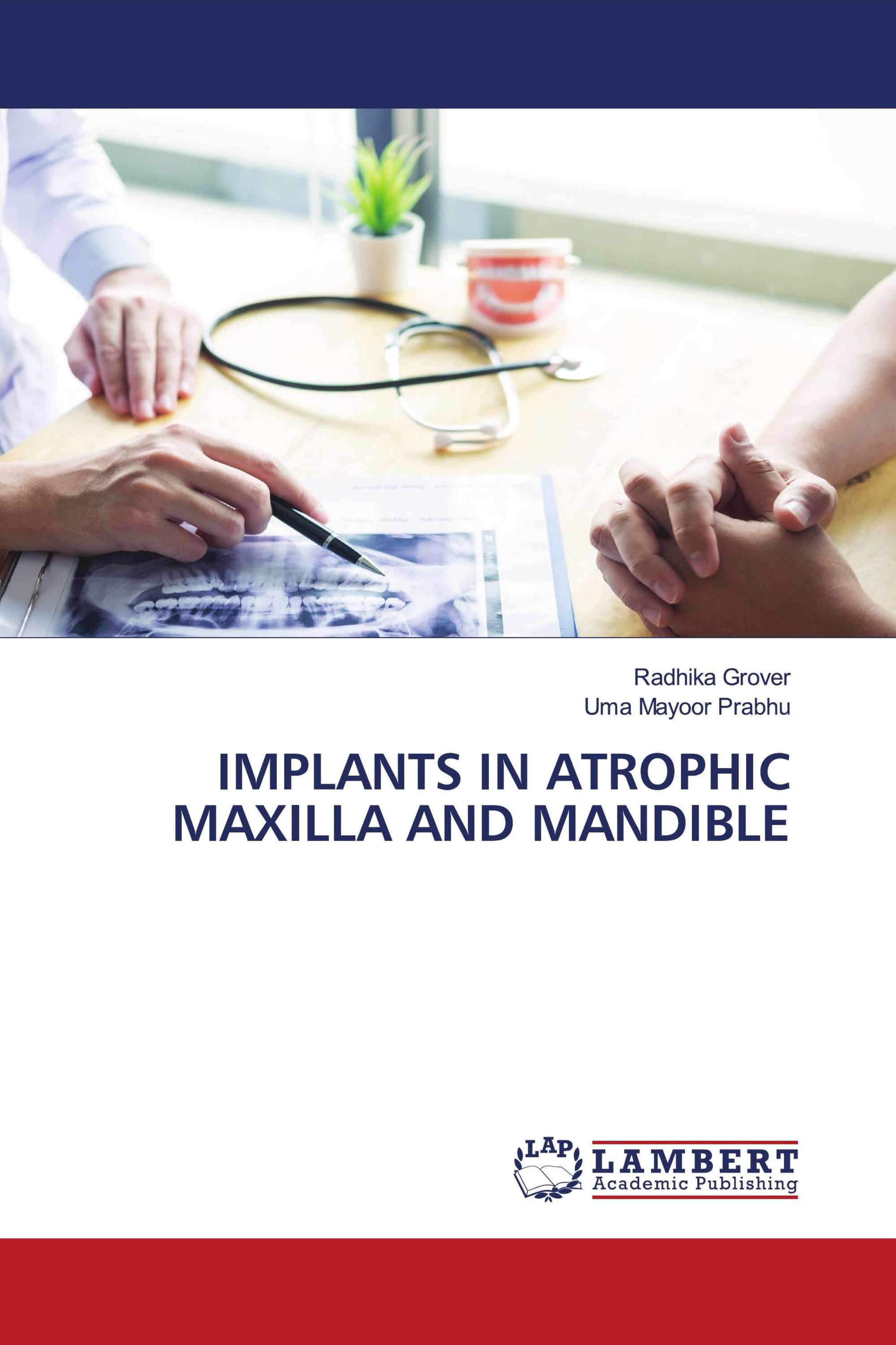 IMPLANTS IN ATROPHIC MAXILLA AND MANDIBLE