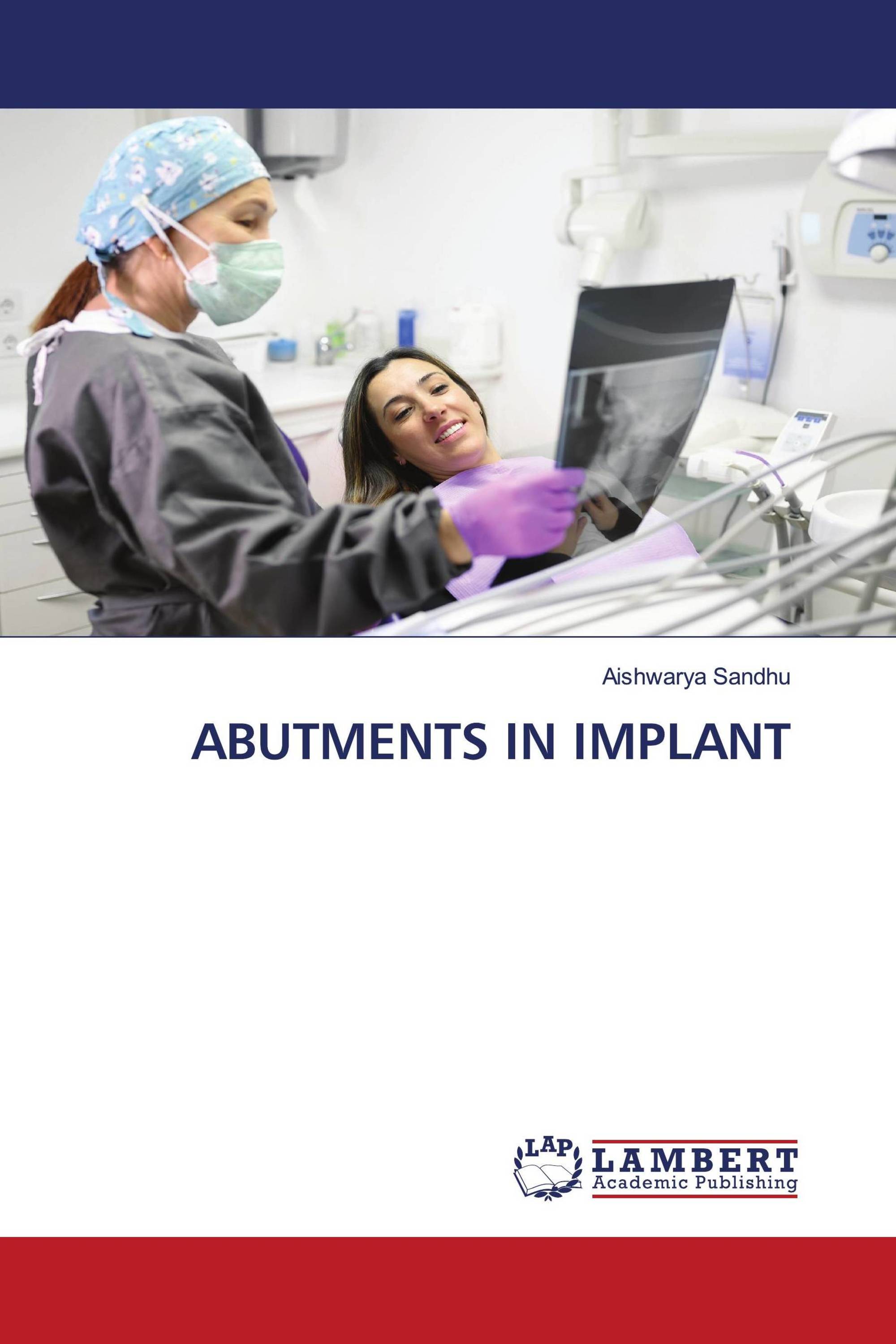 ABUTMENTS IN IMPLANT