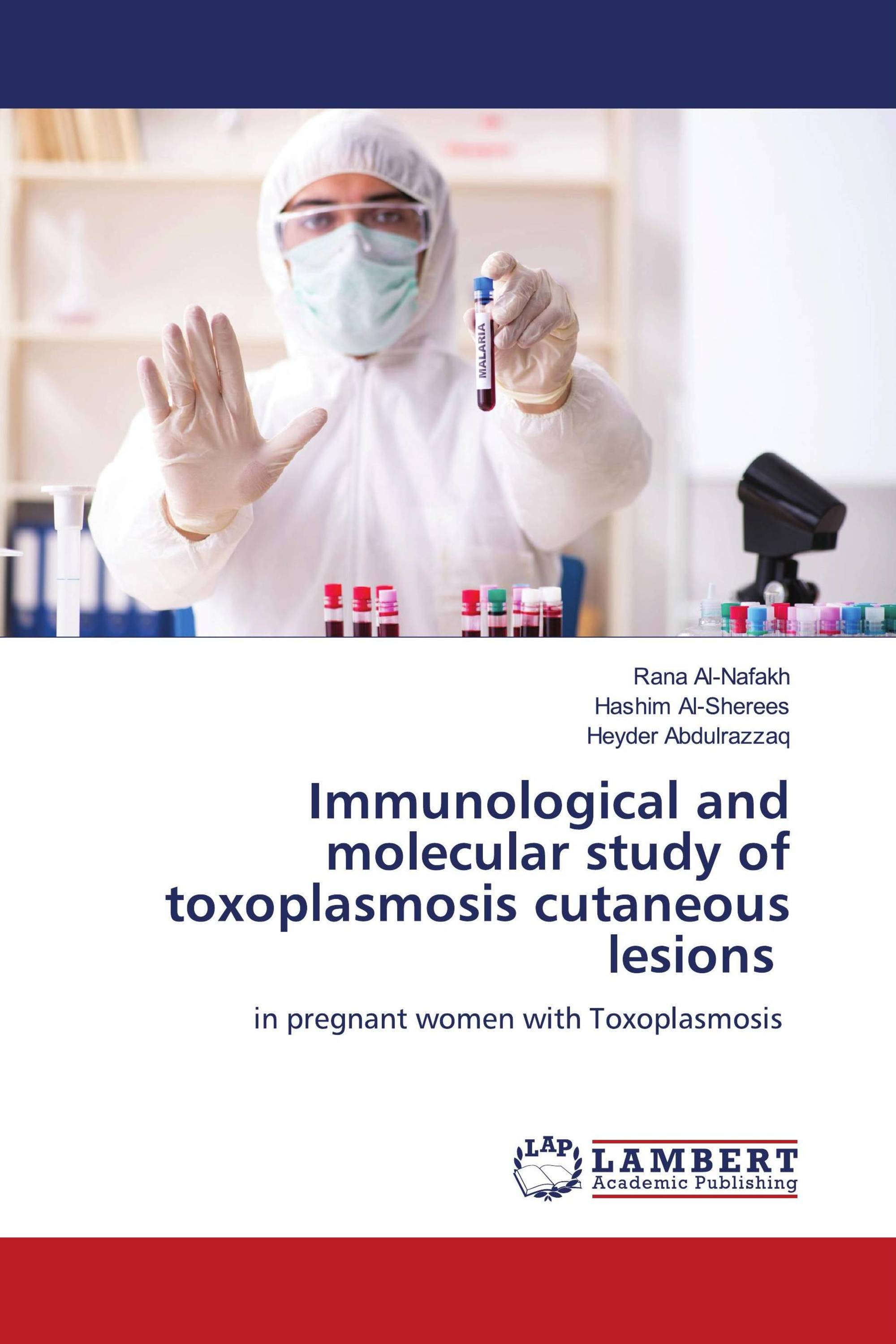 Immunological and molecular study of toxoplasmosis cutaneous lesions