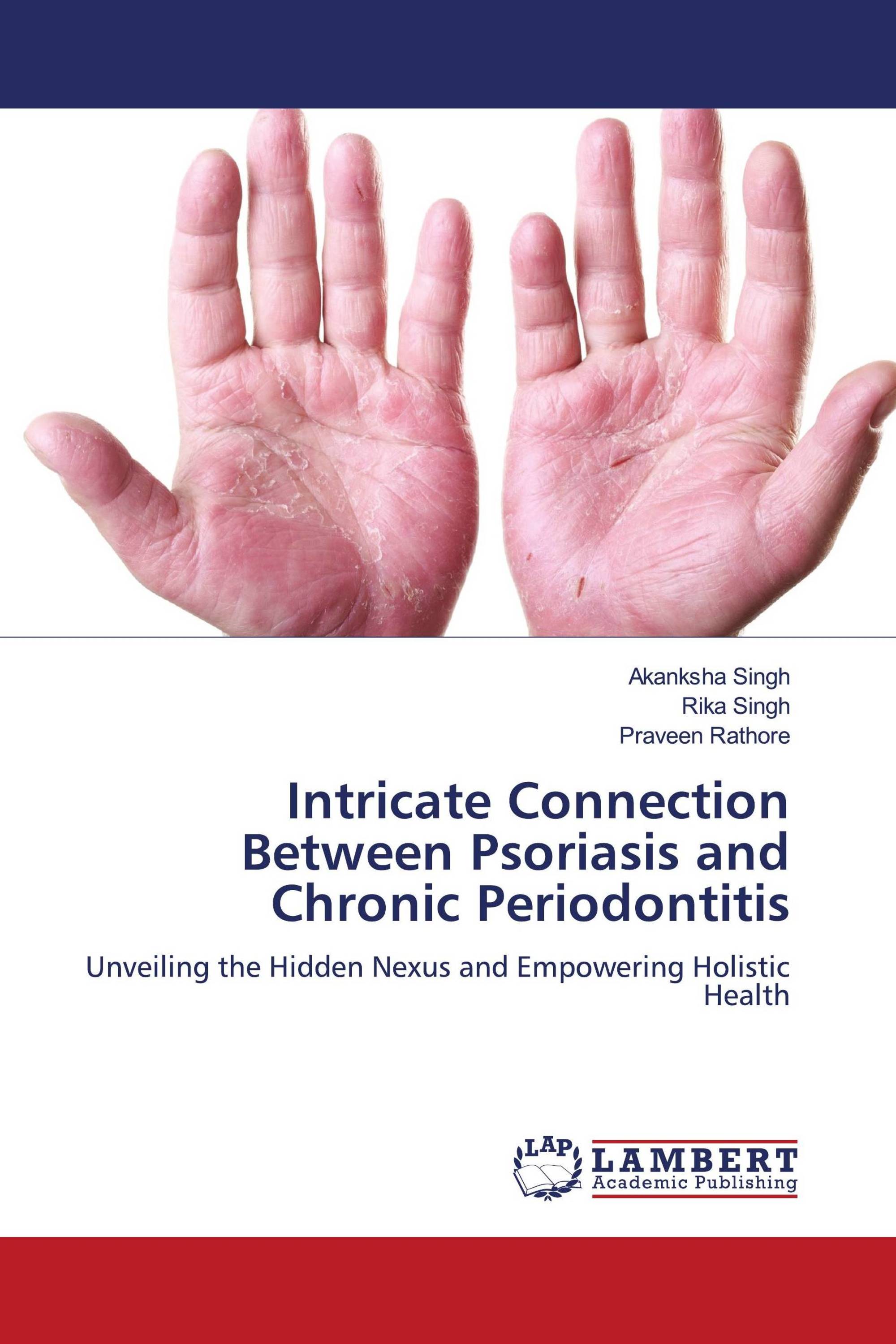 Intricate Connection Between Psoriasis and Chronic Periodontitis