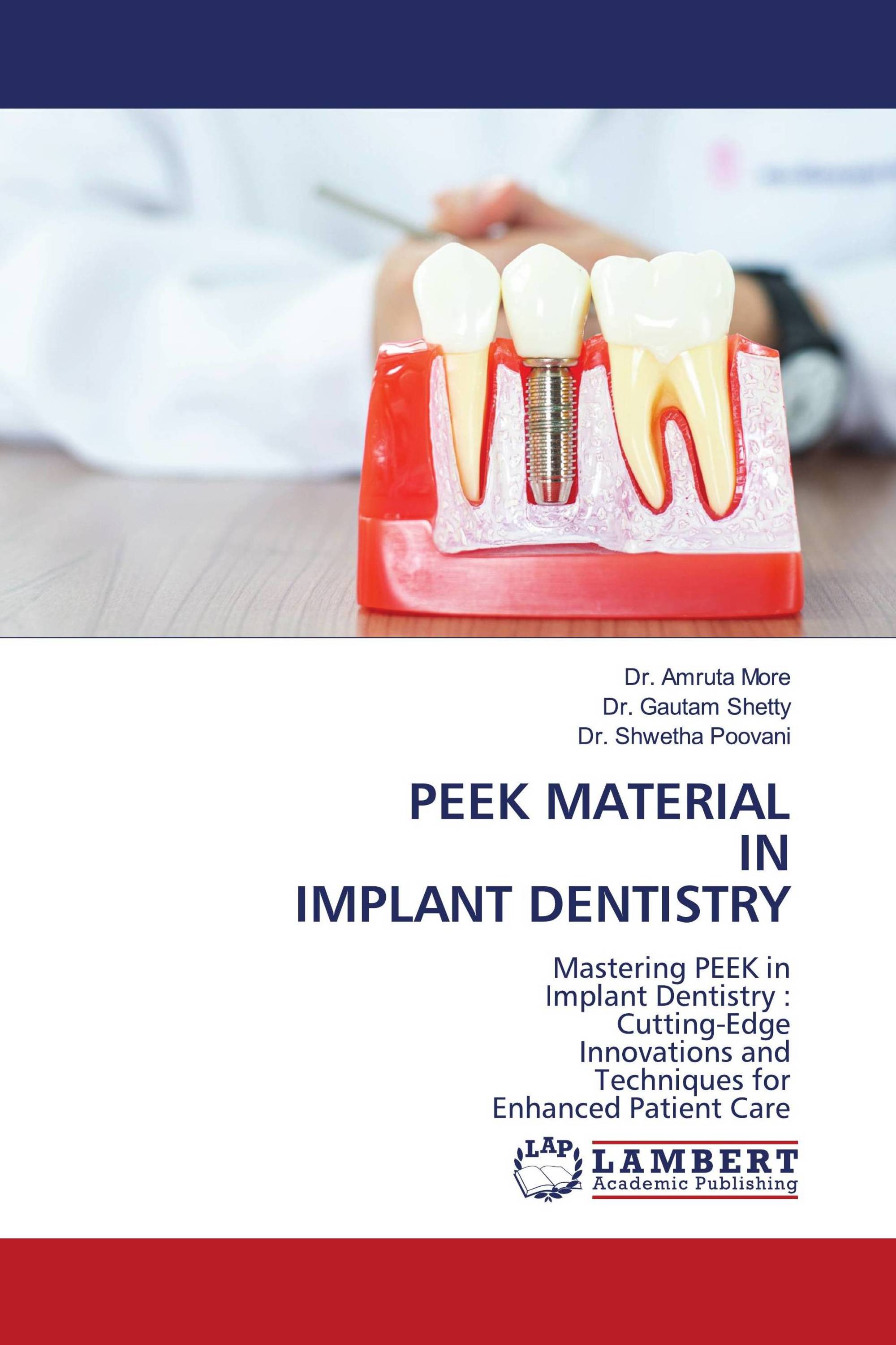 PEEK MATERIAL IN IMPLANT DENTISTRY