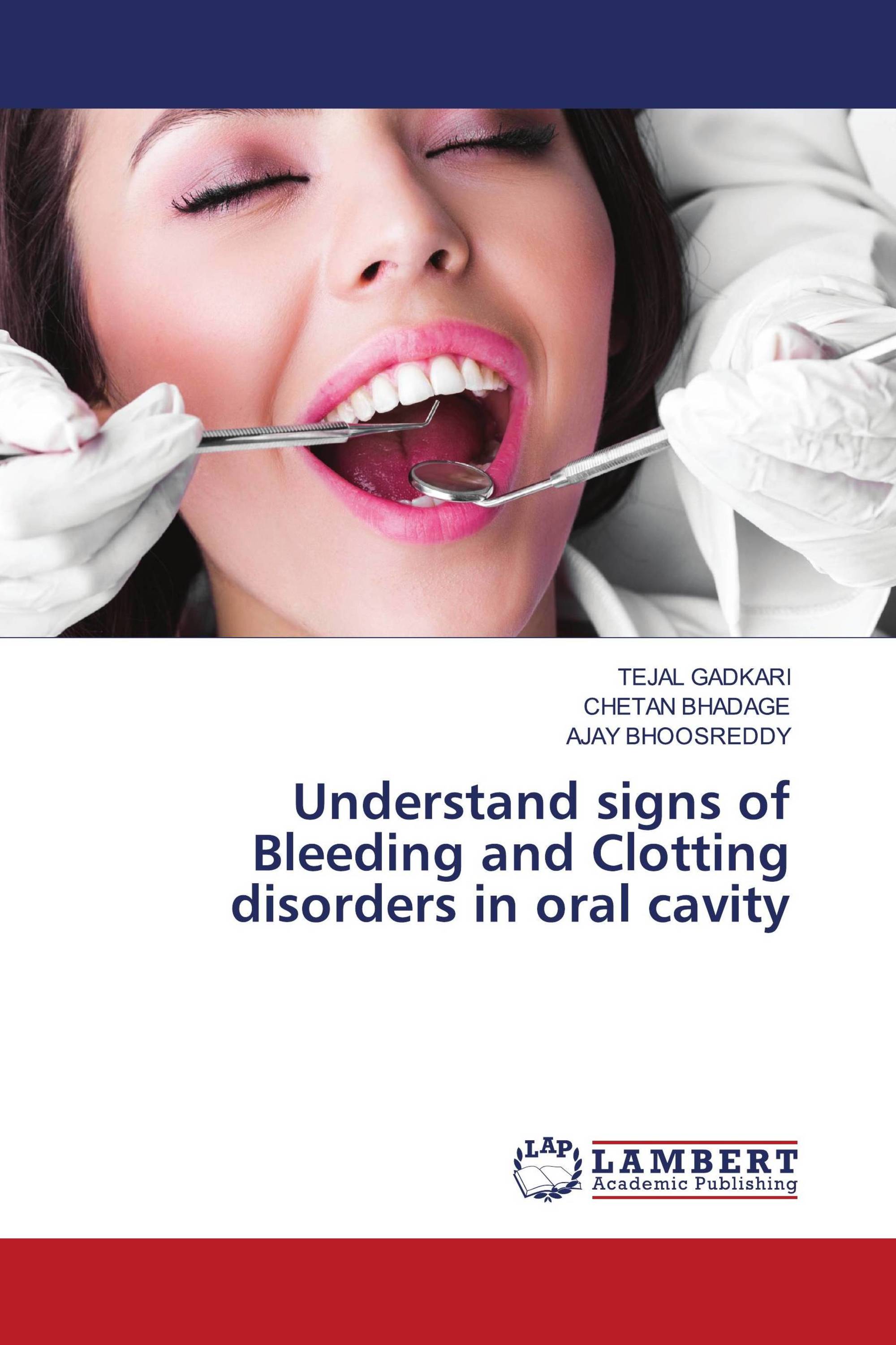 Understand signs of Bleeding and Clotting disorders in oral cavity