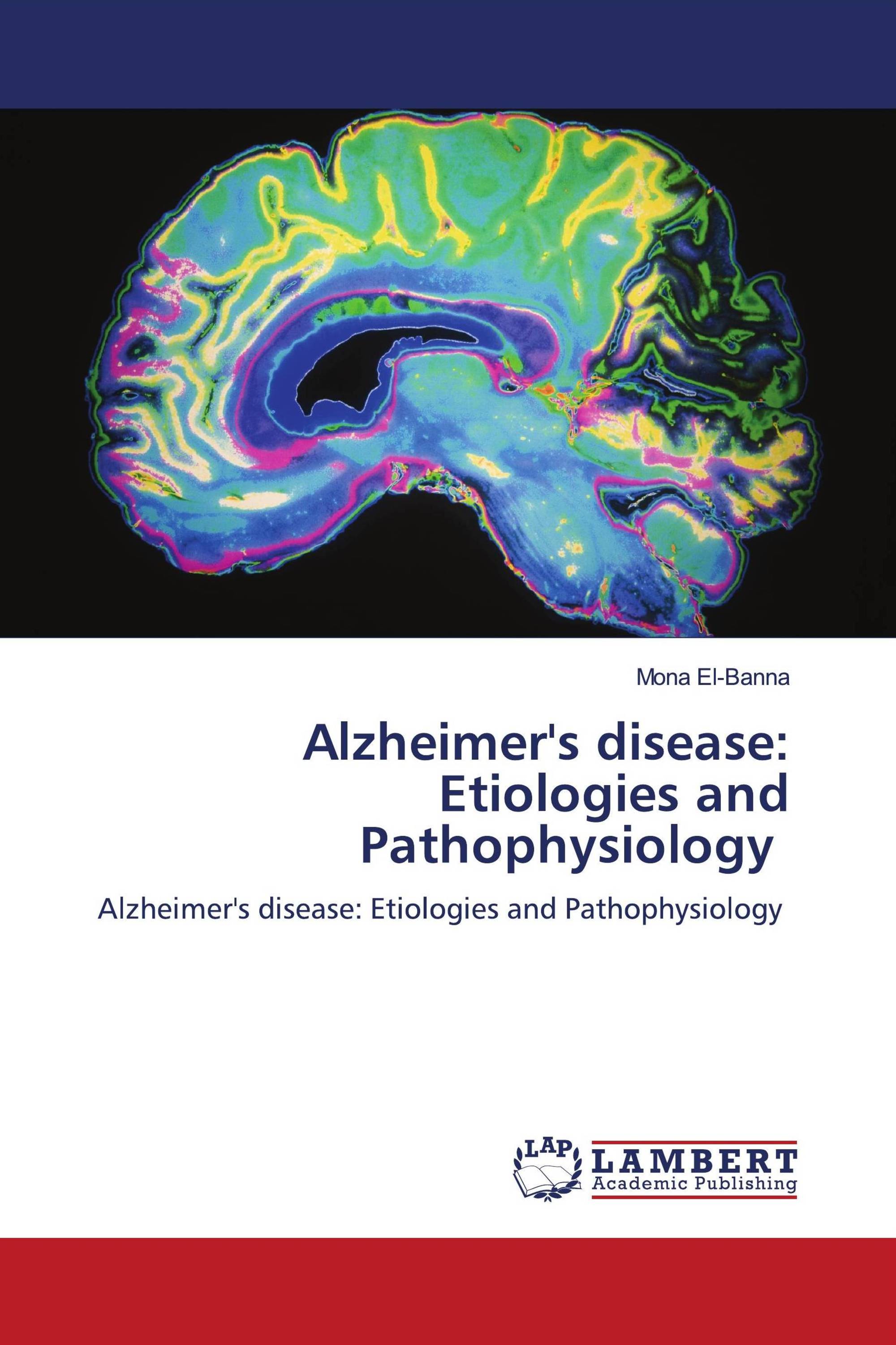 Alzheimer's disease: Etiologies and Pathophysiology