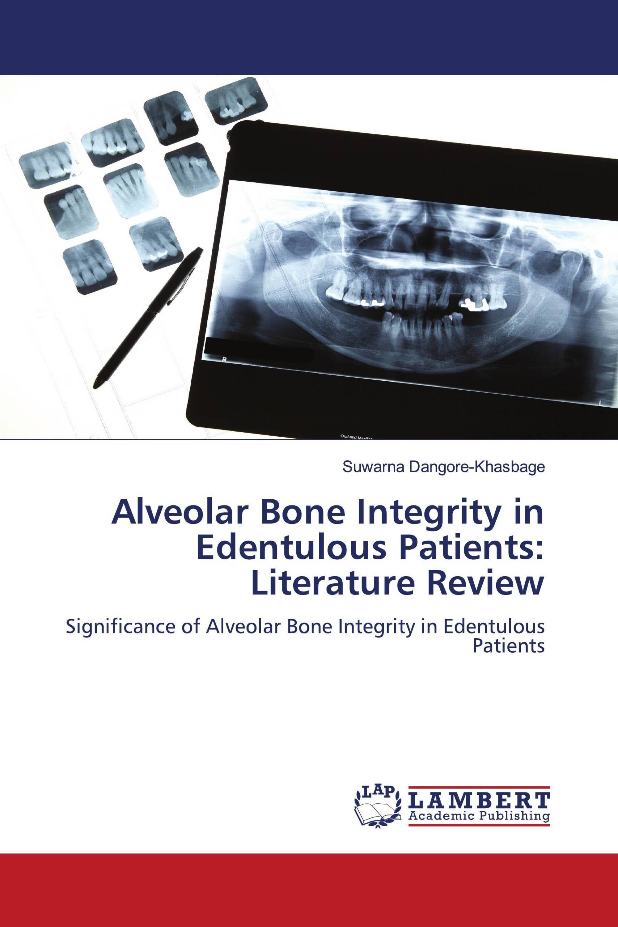 Alveolar Bone Integrity in Edentulous Patients: Literature Review