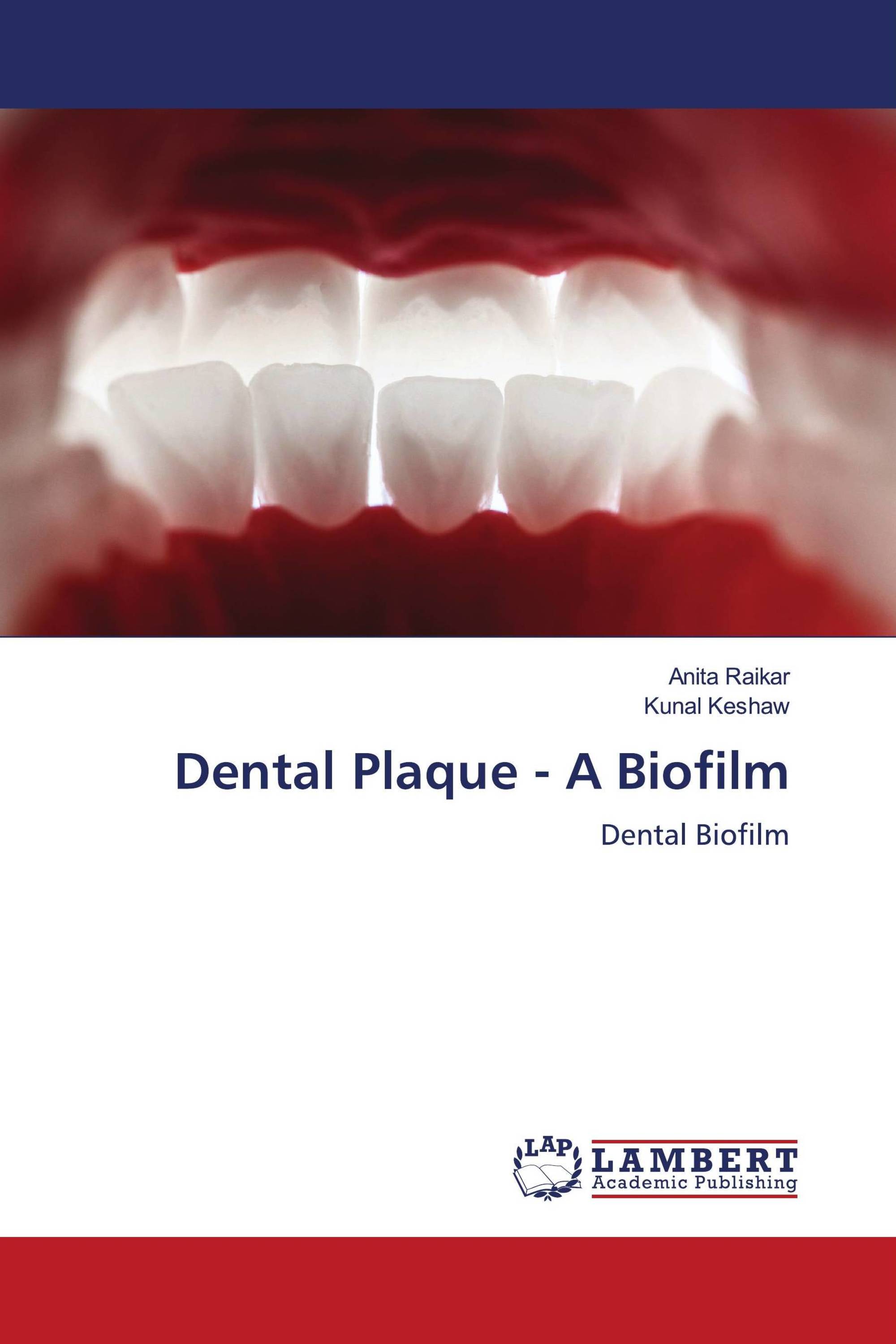 Dental Plaque - A Biofilm