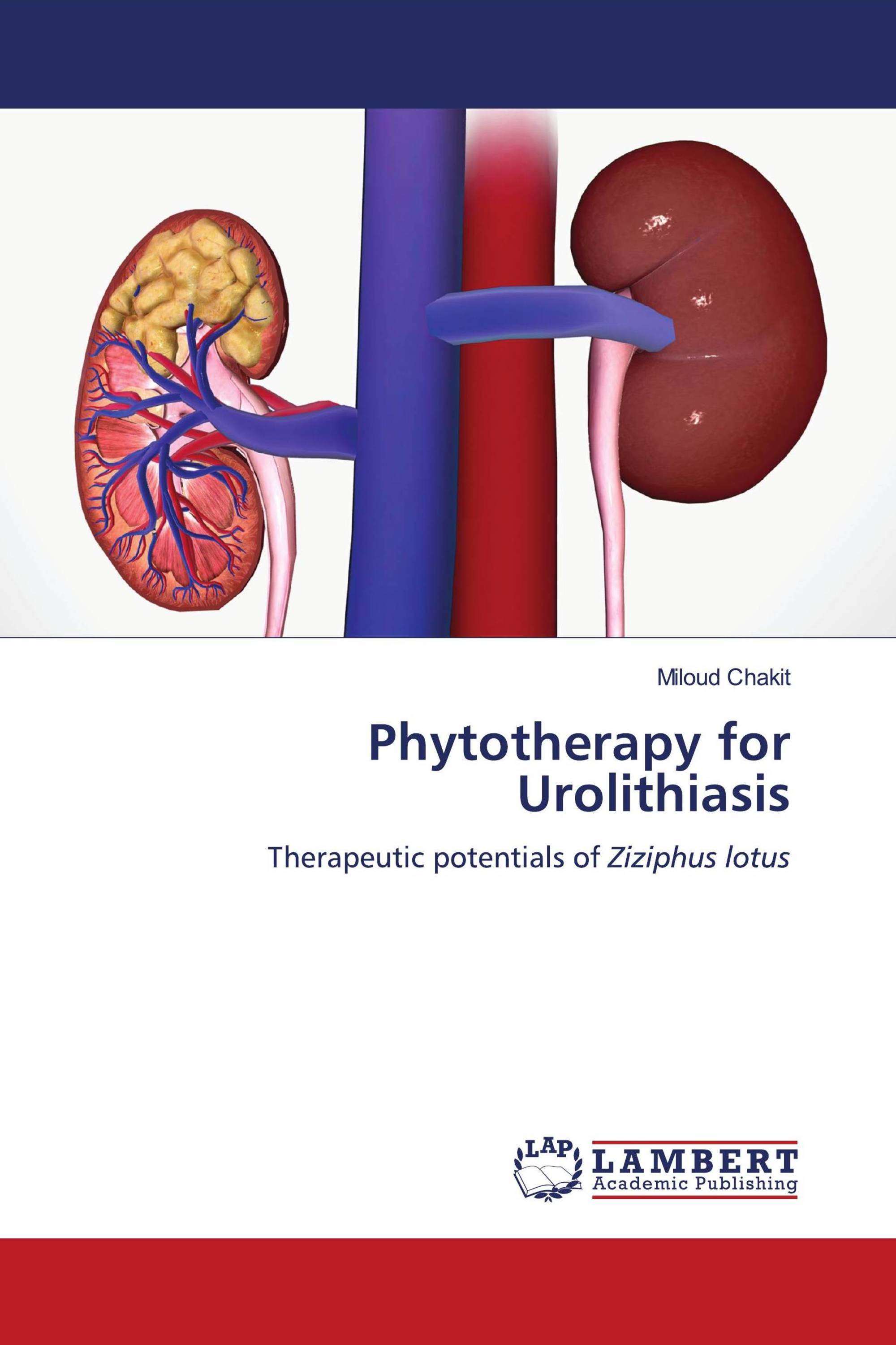 Phytotherapy for Urolithiasis