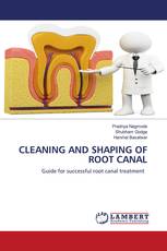 CLEANING AND SHAPING OF ROOT CANAL