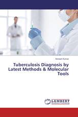 Tuberculosis Diagnosis by Latest Methods & Molecular Tools