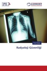 Radyoloji Güvenliği