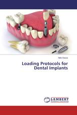 Loading Protocols for Dental Implants
