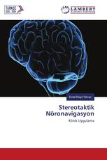 Stereotaktik Nöronavigasyon