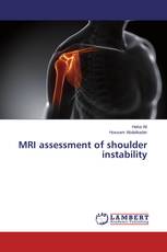 MRI assessment of shoulder instability