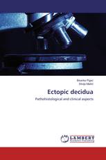Ectopic decidua