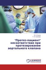 "Протез-пациент" несоответствие при протезировании аортального клапана