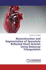 Reconstruction and Segmentation of Specularly Reflected Heart Arteries Using Delaunay Triangulation