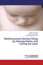 Reinforcement Dental Filling by Nanoparticles and Curing by Laser