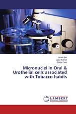 Micronuclei in Oral & Urothelial cells associated with Tobacco habits