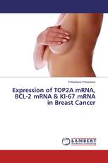 Expression of TOP2A mRNA, BCL-2 mRNA & KI-67 mRNA in Breast Cancer